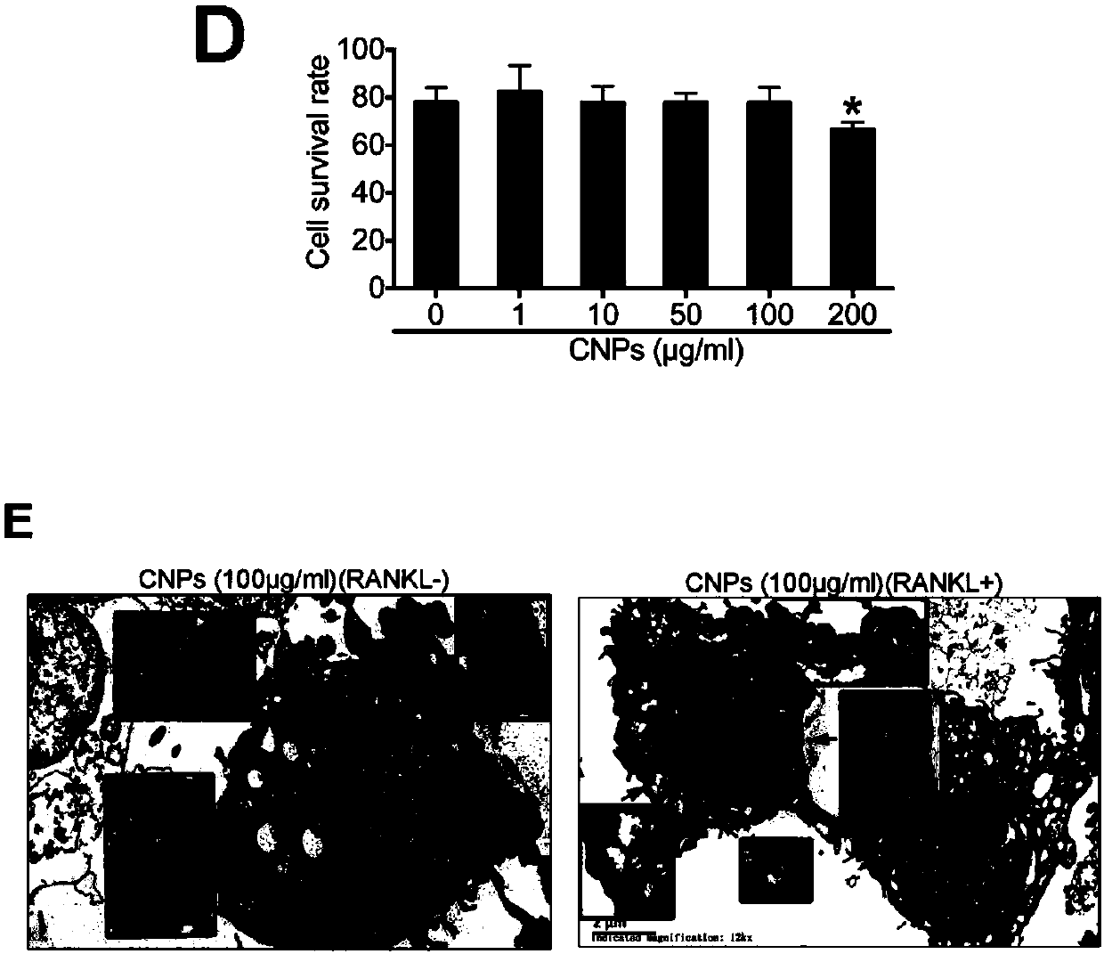 Applications of pH-responsive nanometer material in preparation of anti-bone resorption drugs with effects of osteoporosis prevention and treatment