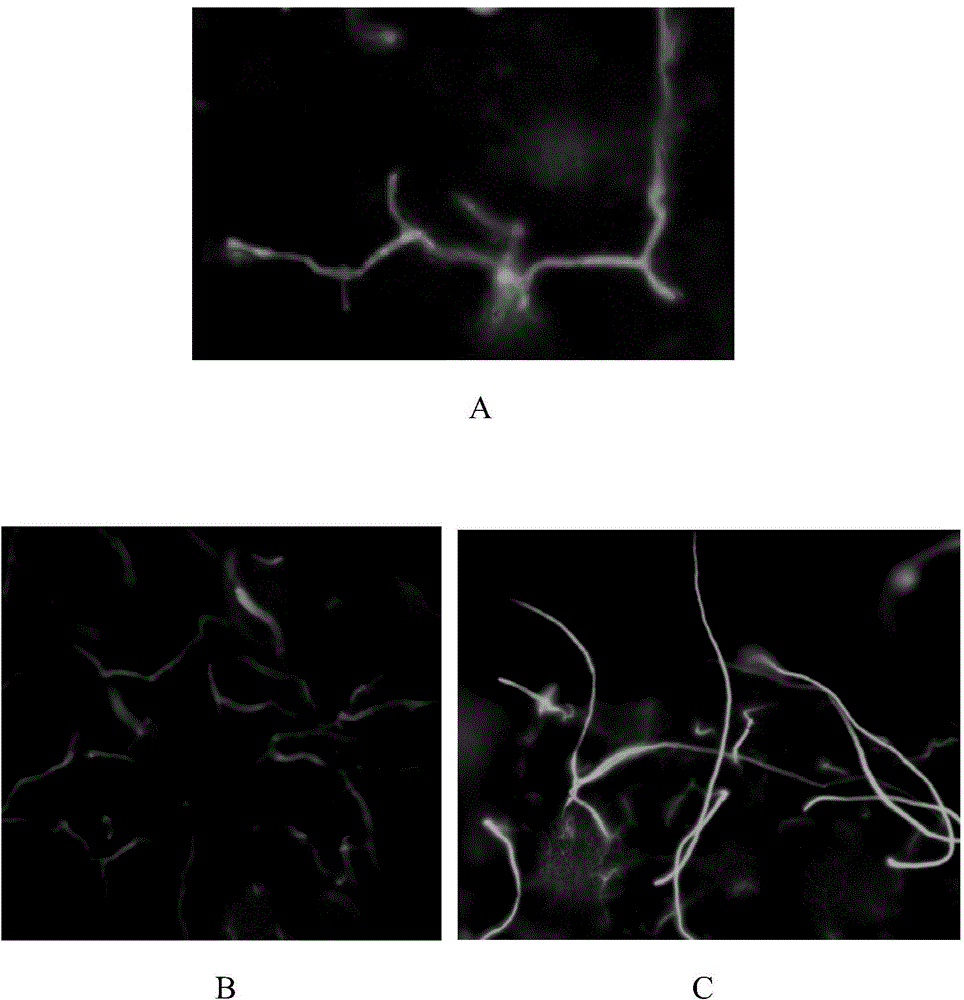 Fungus fluorescence staining method and application thereof