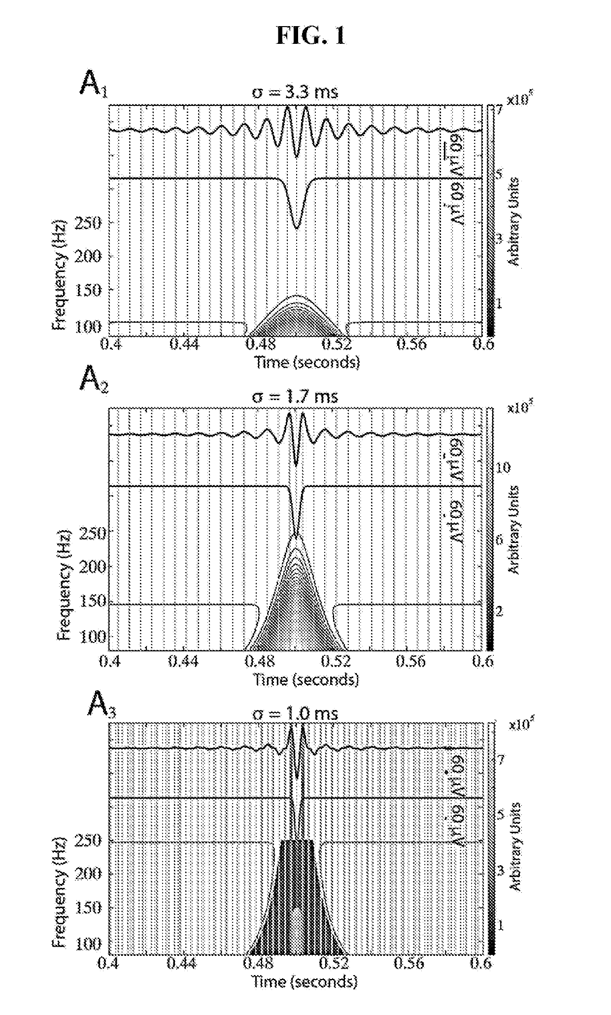 Signal processing method for distinguishing and characterizing high-frequency oscillations