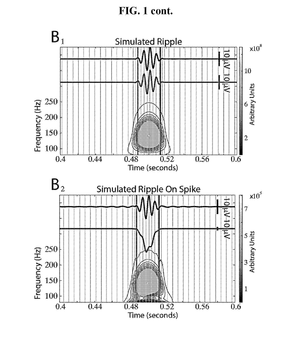 Signal processing method for distinguishing and characterizing high-frequency oscillations