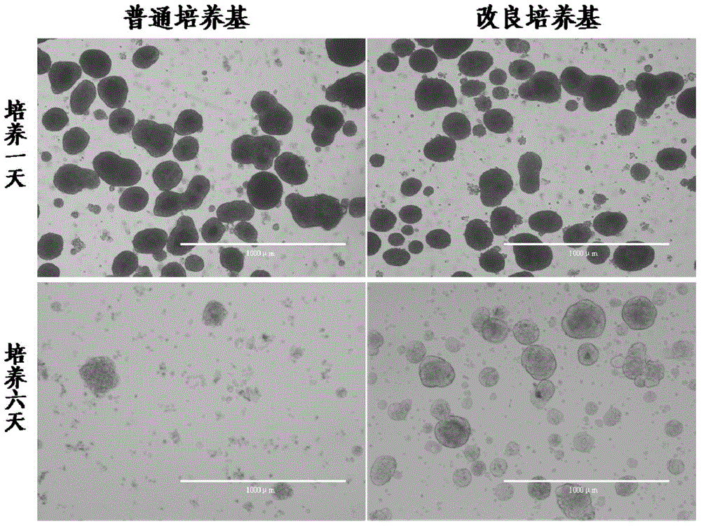 A kind of improved neonatal porcine islet cell culture medium and using method thereof