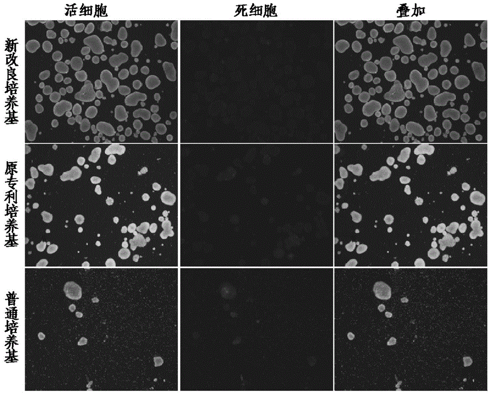 A kind of improved neonatal porcine islet cell culture medium and using method thereof