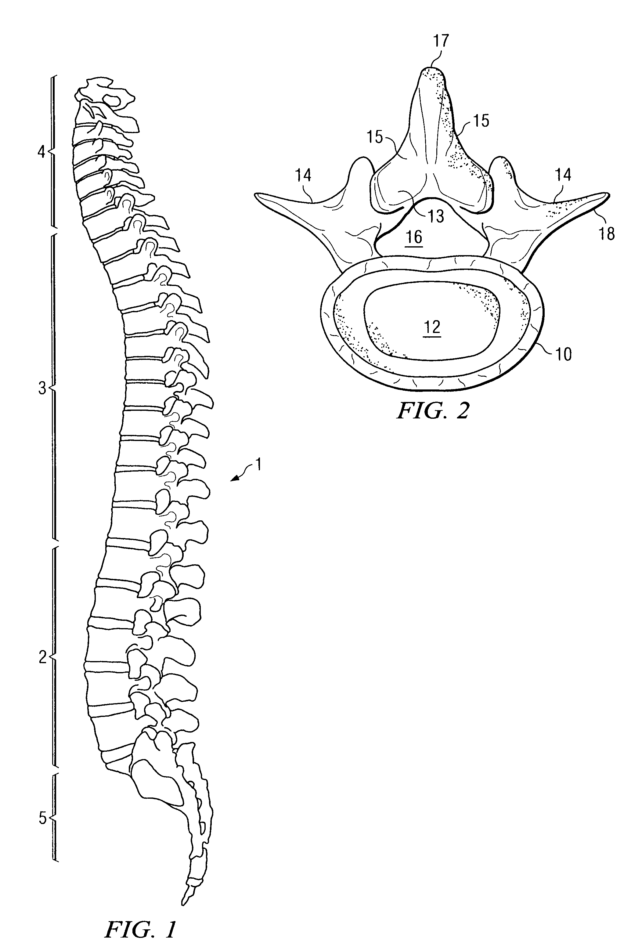 Electromagnetic apparatus and method for nerve localization during spinal surgery