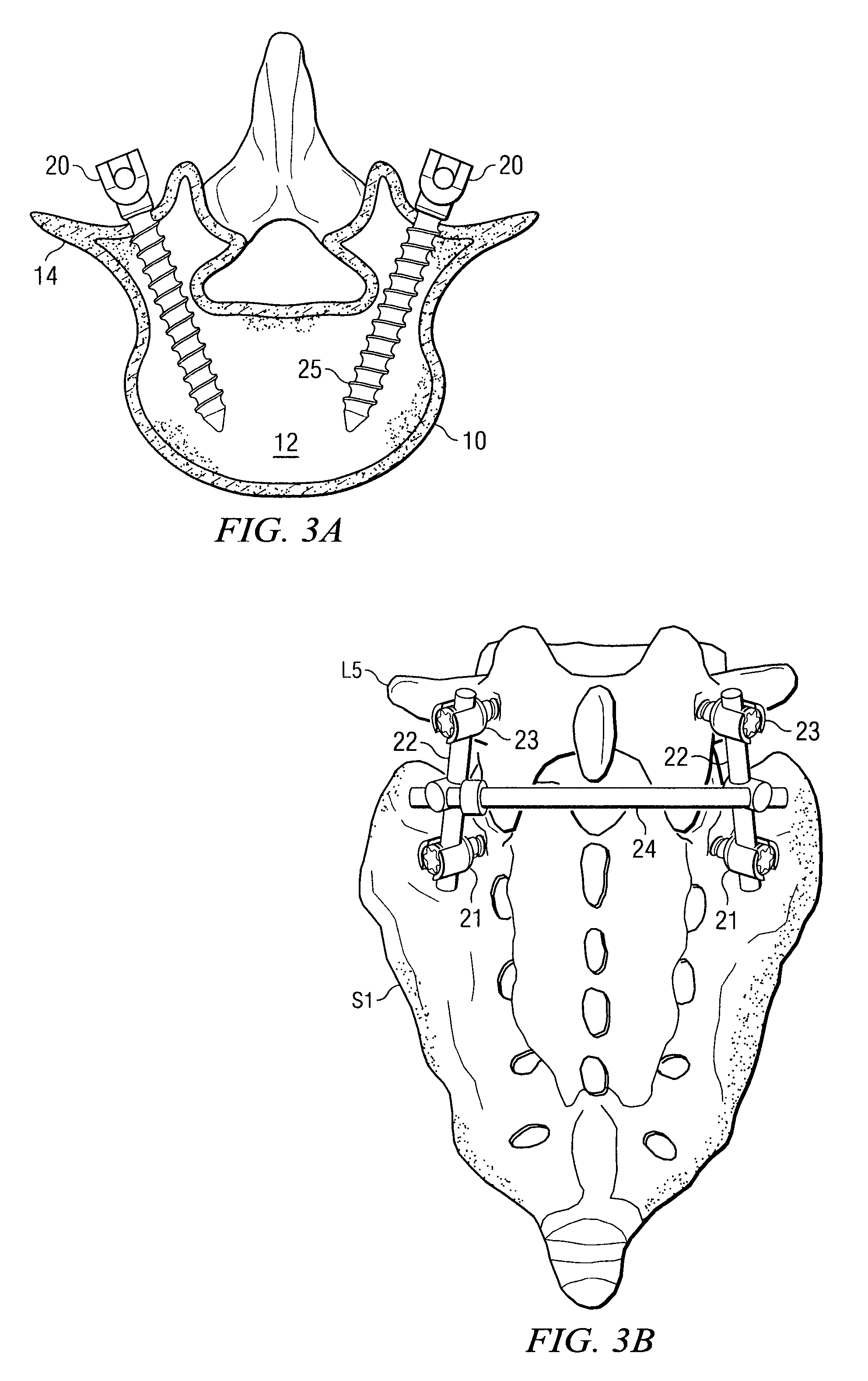 Electromagnetic apparatus and method for nerve localization during spinal surgery