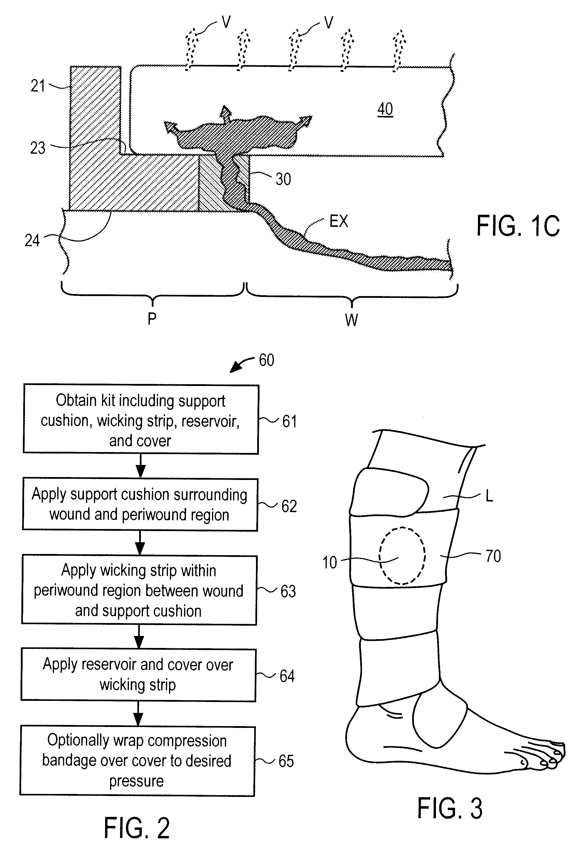 Systems and methods for wound protection and exudate management