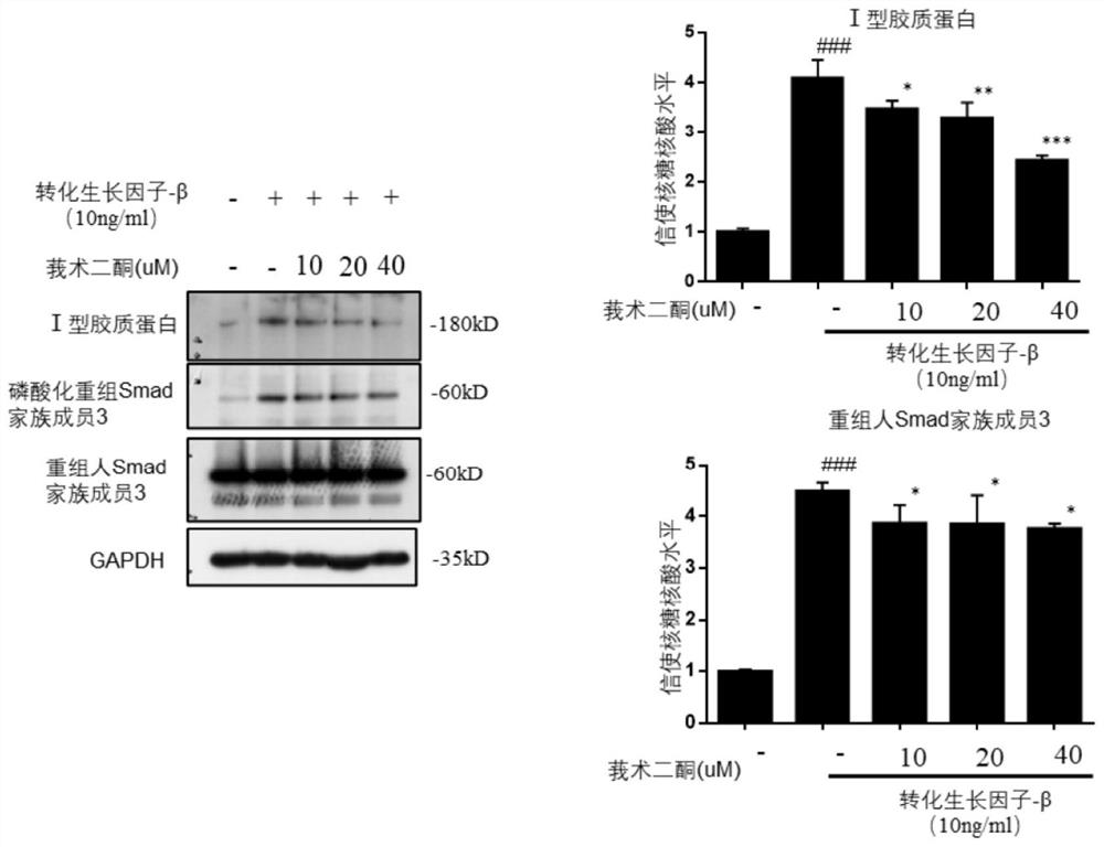 Pharmaceutical composition for treating chronic liver injury and application of pharmaceutical composition