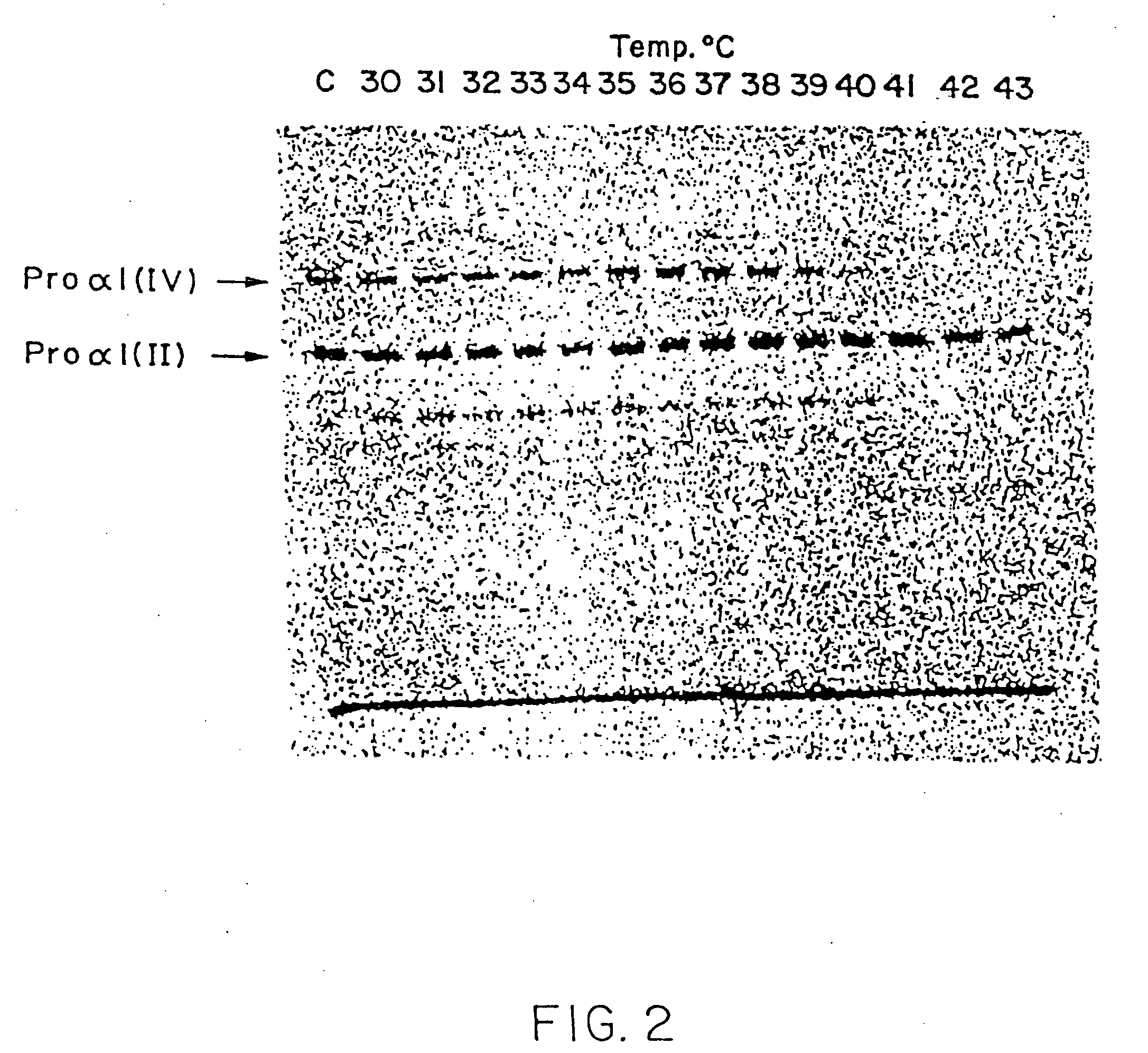 Synthesis of human procollagens and collagens in recombinant DNA systems