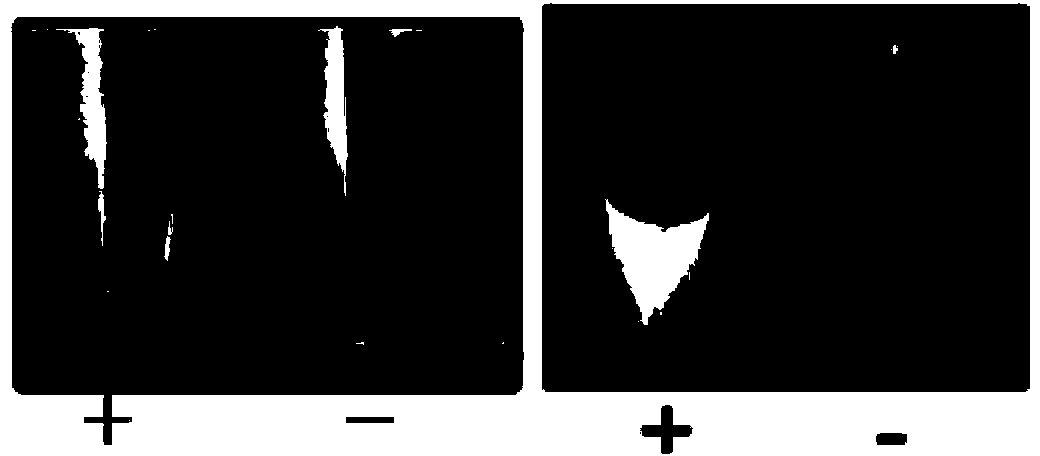 Method and primer composition for detecting soybean fusarium oxysporum based on LAMP (loop-mediated isothermal amplification) technology