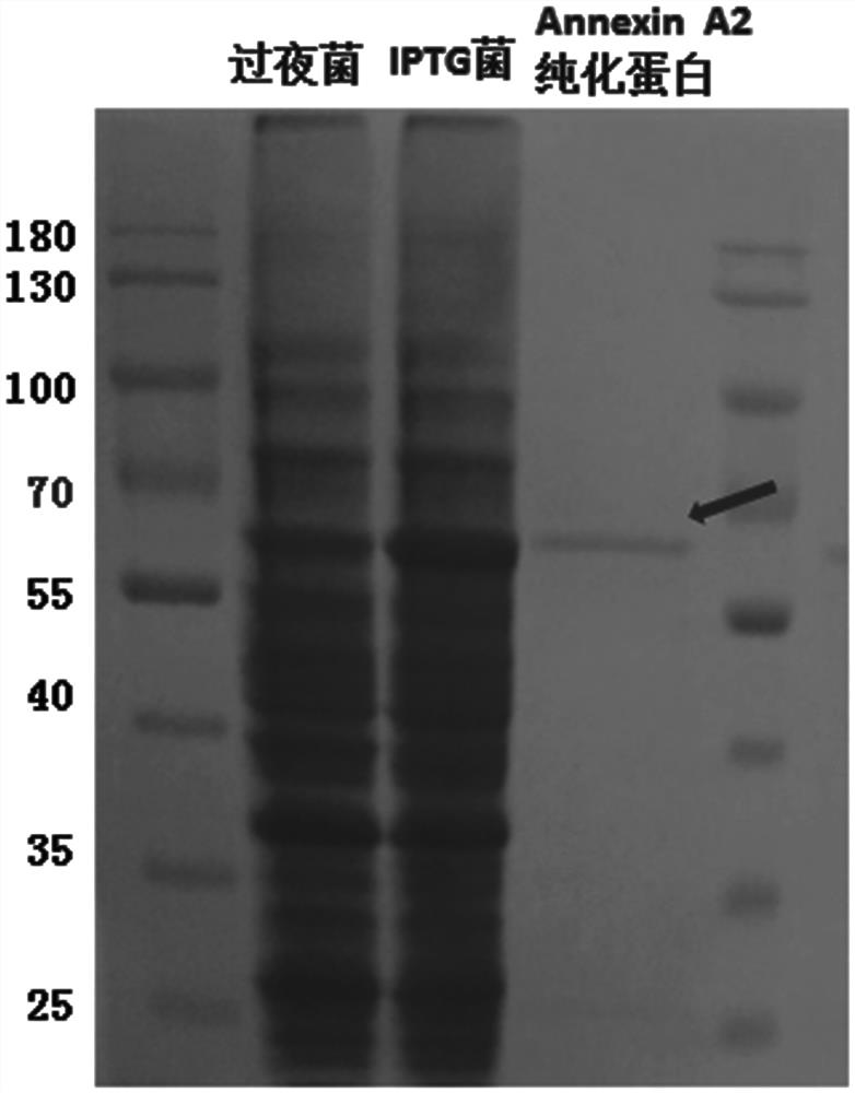 Affinity short peptide for targeted recognition of Annexin A2 and preparation method and use of affinity short peptide