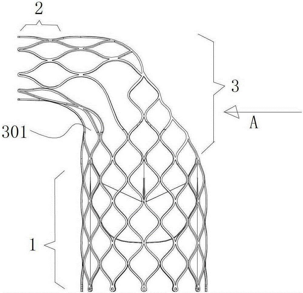 Pulmonary valve replacement device and its stent