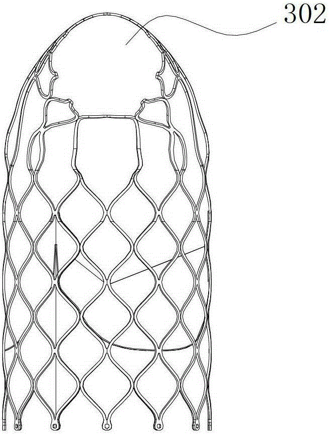 Pulmonary valve replacement device and its stent