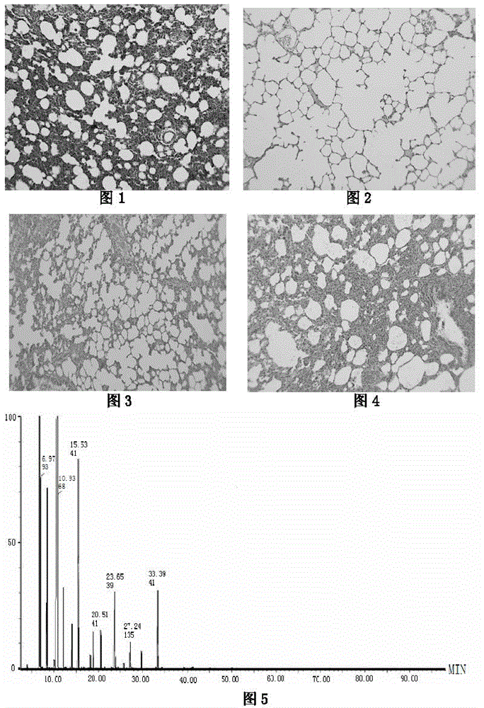 Application of volatile oil of Uyghur medicine Tumor Nigella in preparation of medicine for treating chronic obstructive pulmonary disease