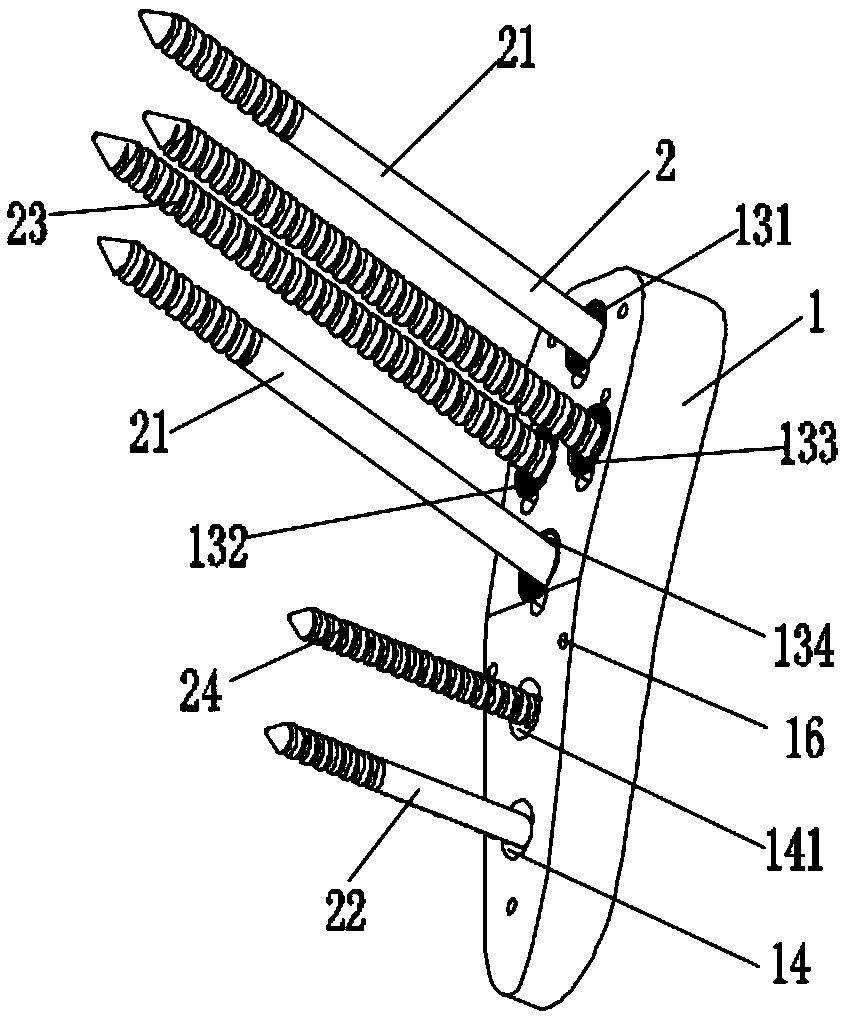 Universal locking device of femoral neck and femoral neck operation method