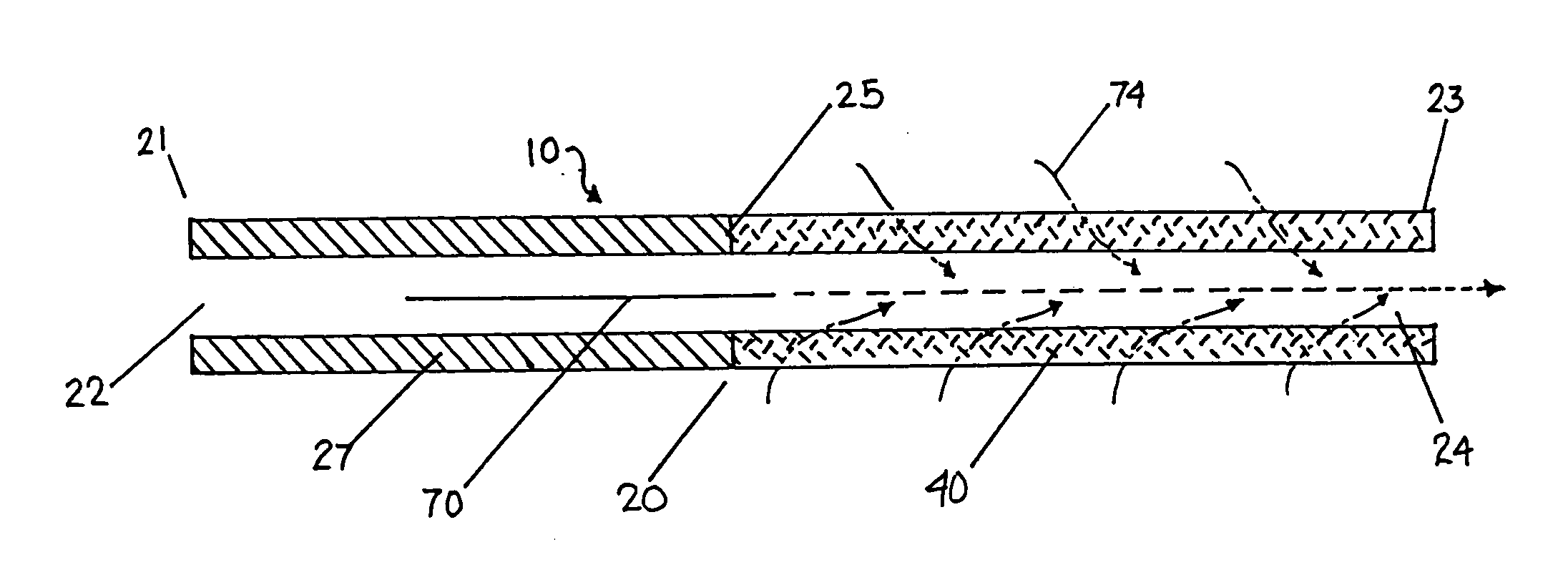 Catheter for modification of agent formulation