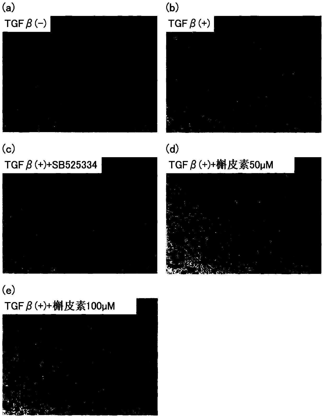 Composition for inhibiting myofibrosis