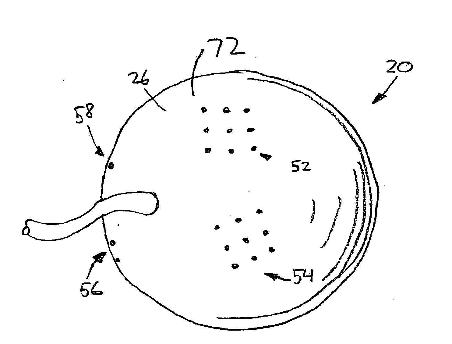 System and Method for Treating Connective Tissue