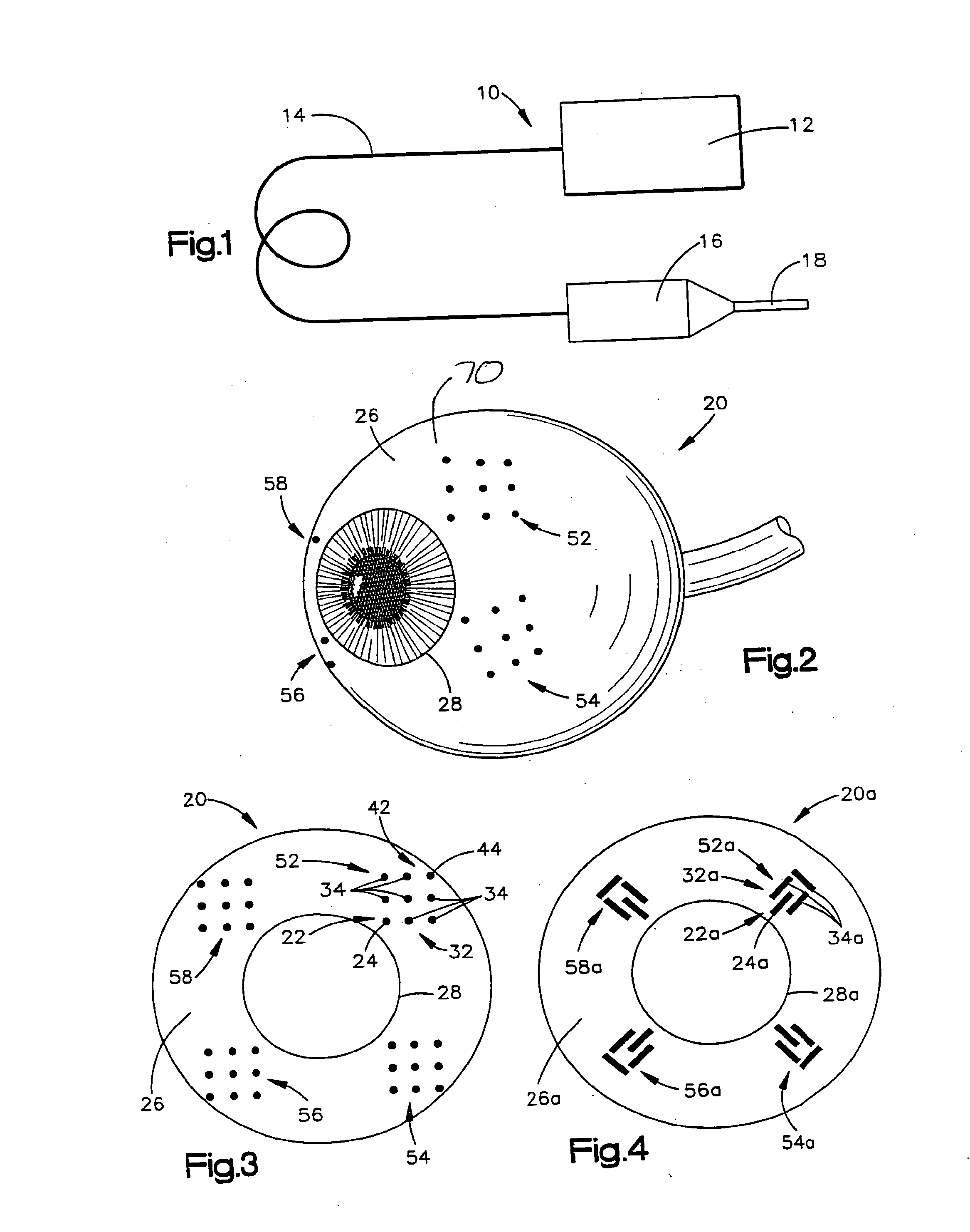 System and Method for Treating Connective Tissue