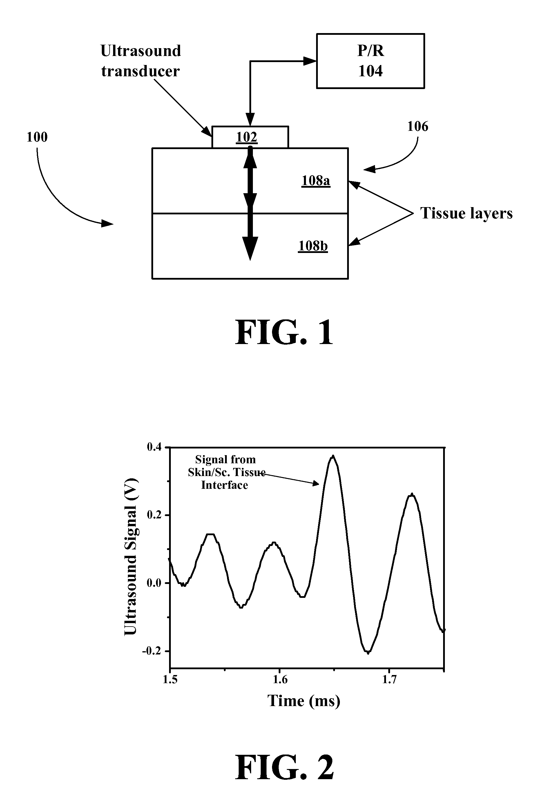 Noninvasive glucose sensing methods and systems