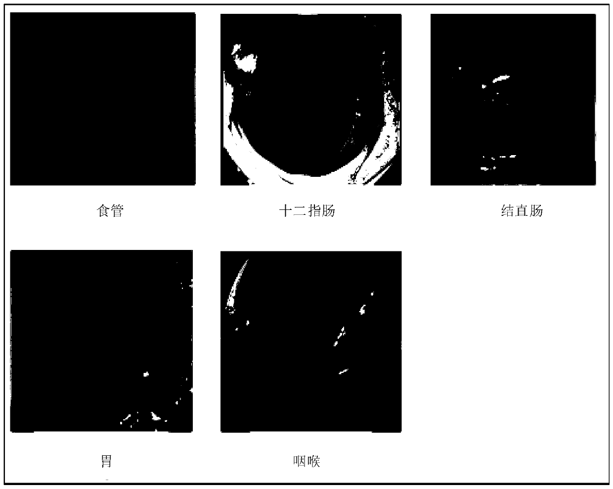 Digestive tract endoscope image processing method and device, storage medium, equipment and system
