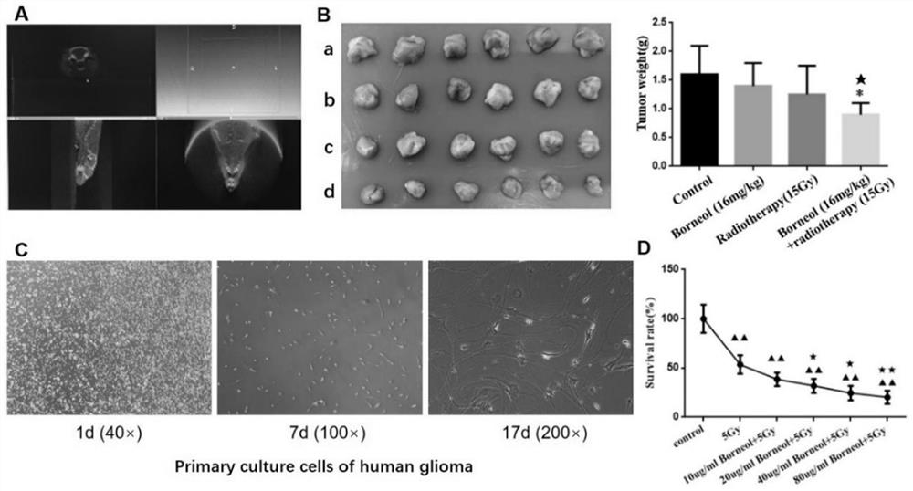 Application of borneol in preparation of brain glioma radiotherapy combined medicine