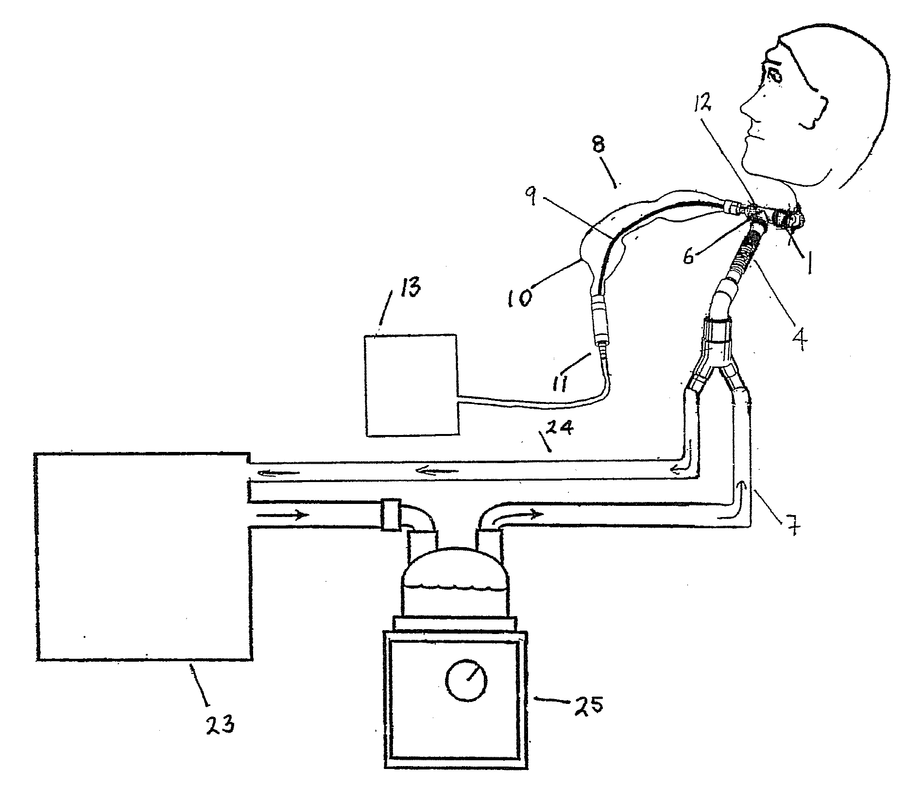 Patient Ventilating And Aspirating System