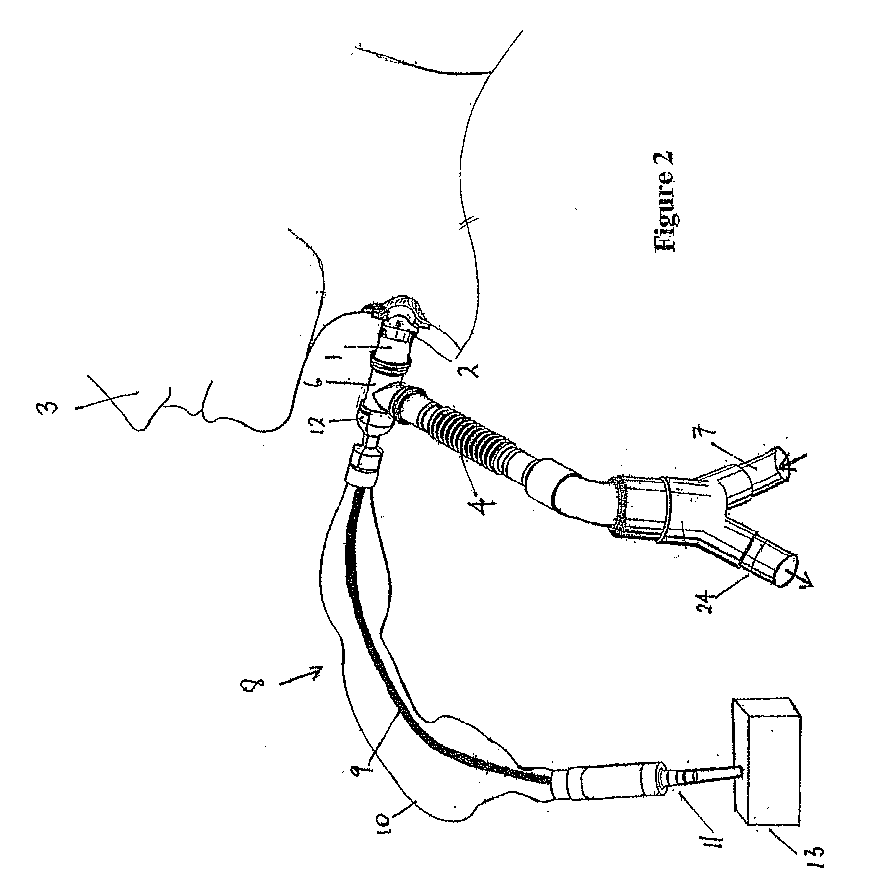 Patient Ventilating And Aspirating System