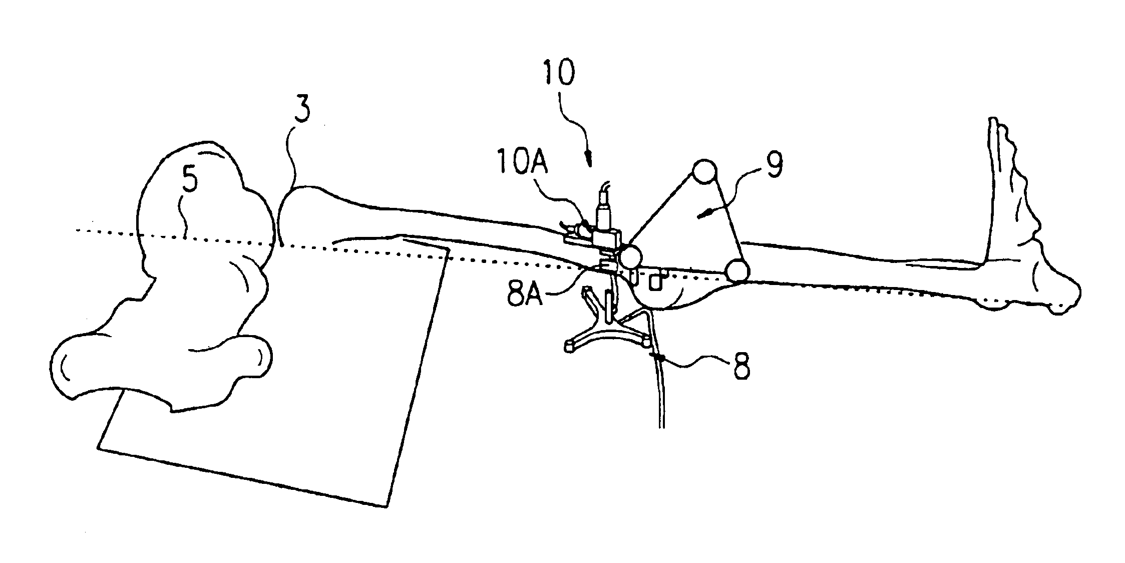 Method and apparatus for finding the position of a mechanical axis of a limb