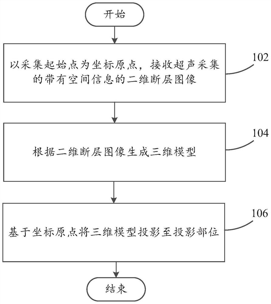 Medical image projection method and device, computer equipment and storage medium