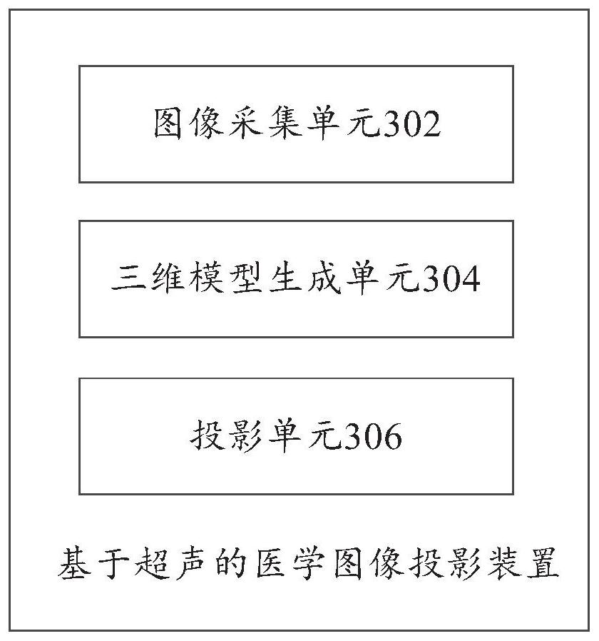 Medical image projection method and device, computer equipment and storage medium