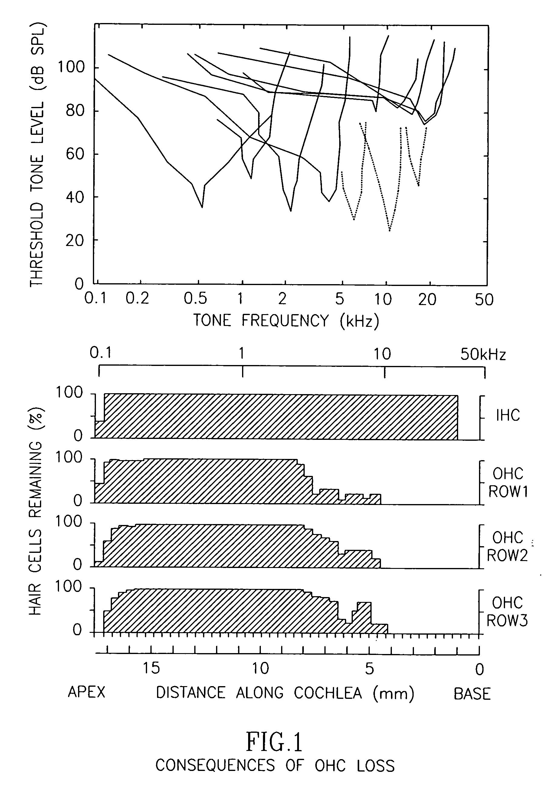 Methods and compositions for the prevention of toxic side effects of aminoglycoside medications