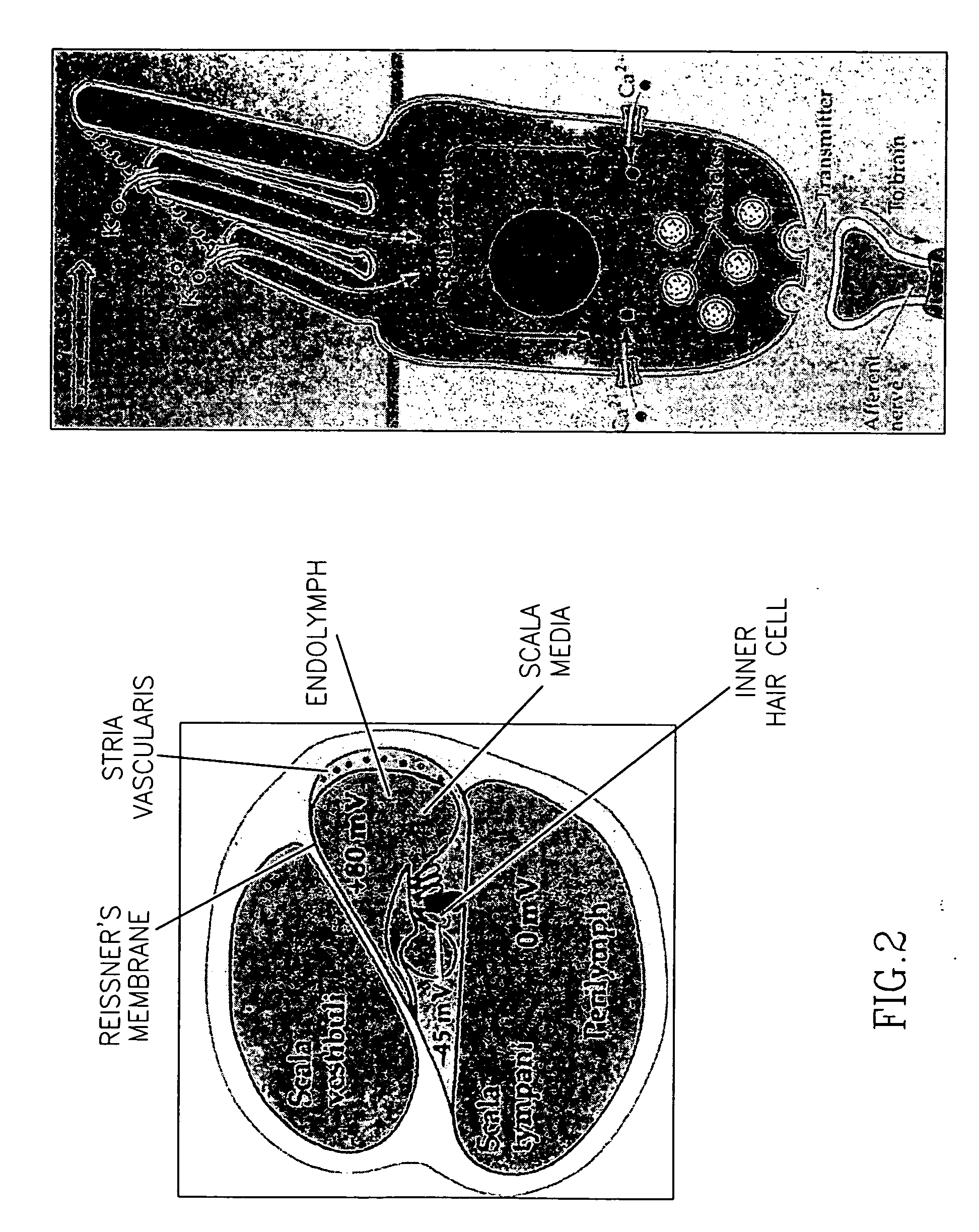 Methods and compositions for the prevention of toxic side effects of aminoglycoside medications