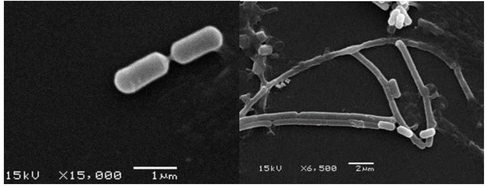 Bacillus licheniformis strain and application thereof