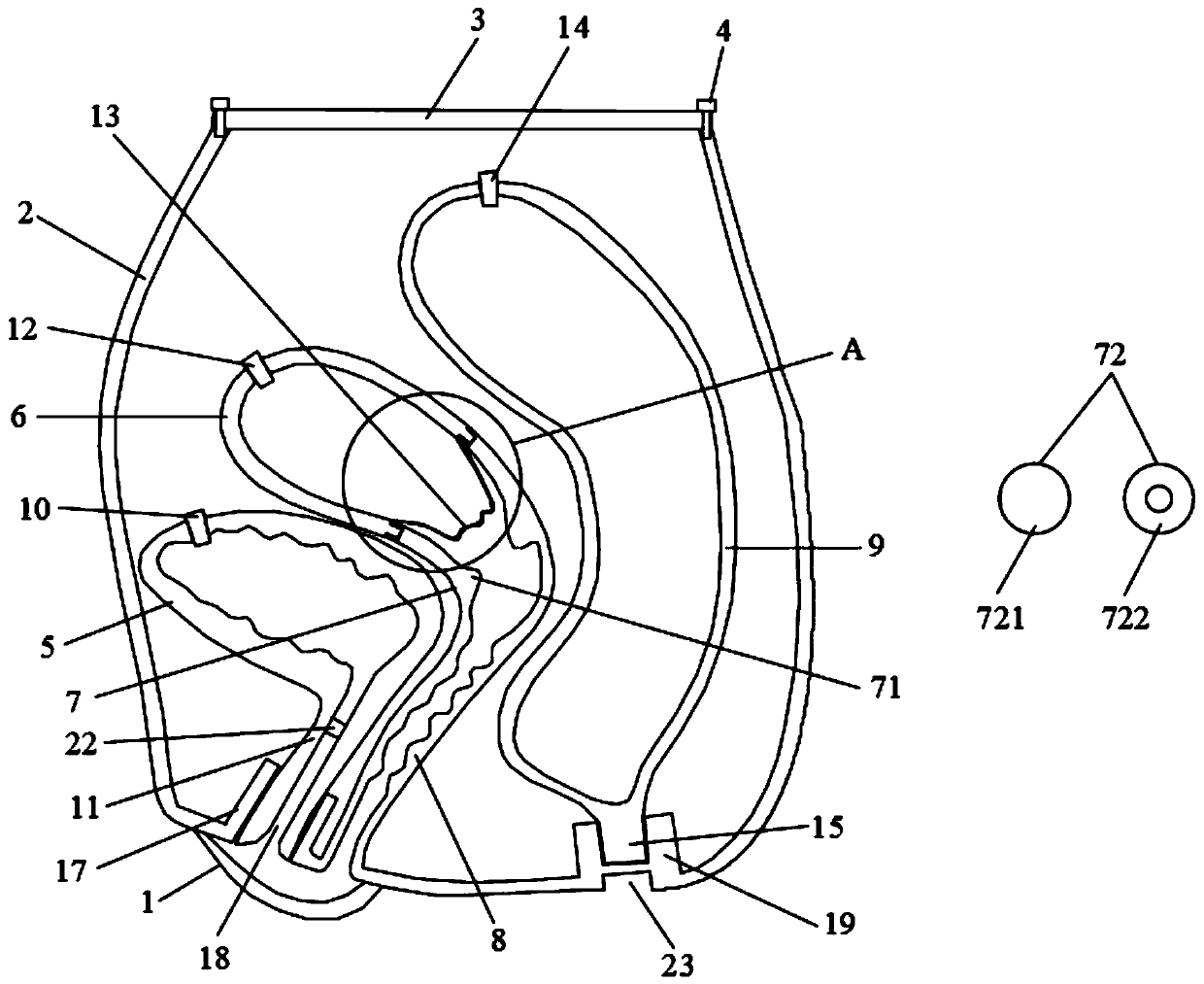 High-fidelity and detachable cervical cerclage simulation teaching model and teaching method