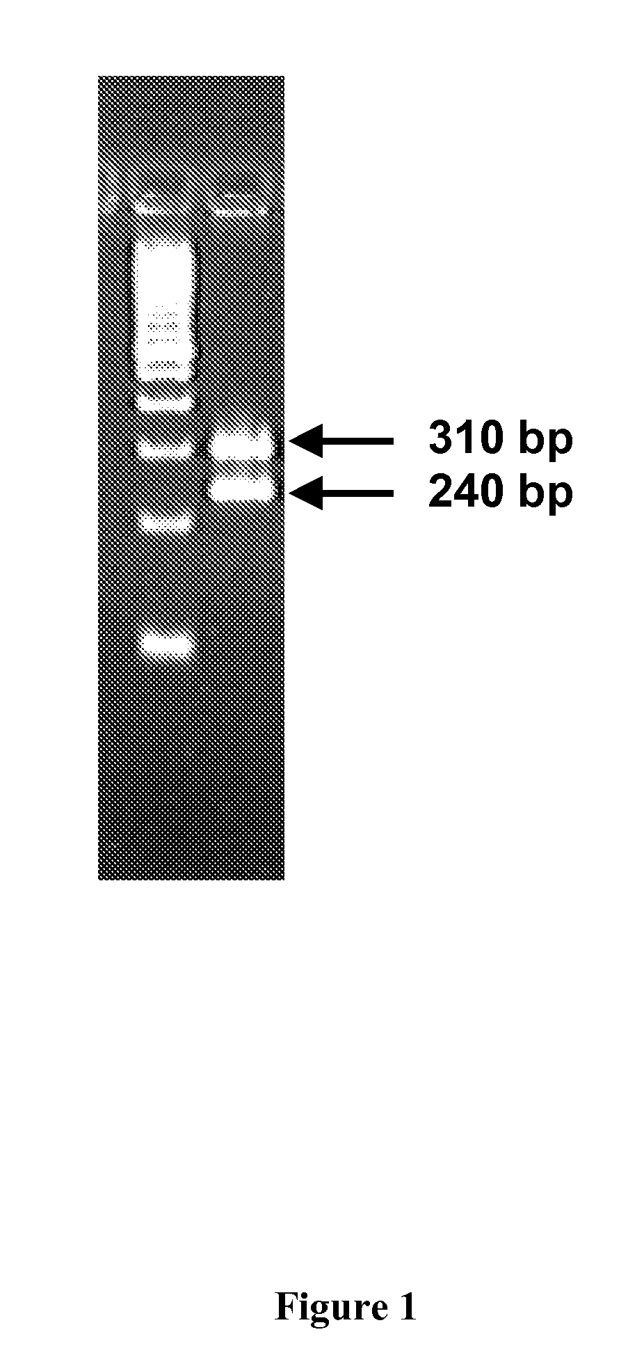 Reagents and Methods for Detecting CYP2C9 Polymorphisms