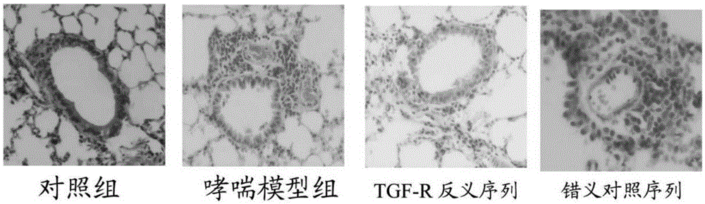 TGF-r antisense sequence and its application in the preparation of anti-airway inflammatory response medicine