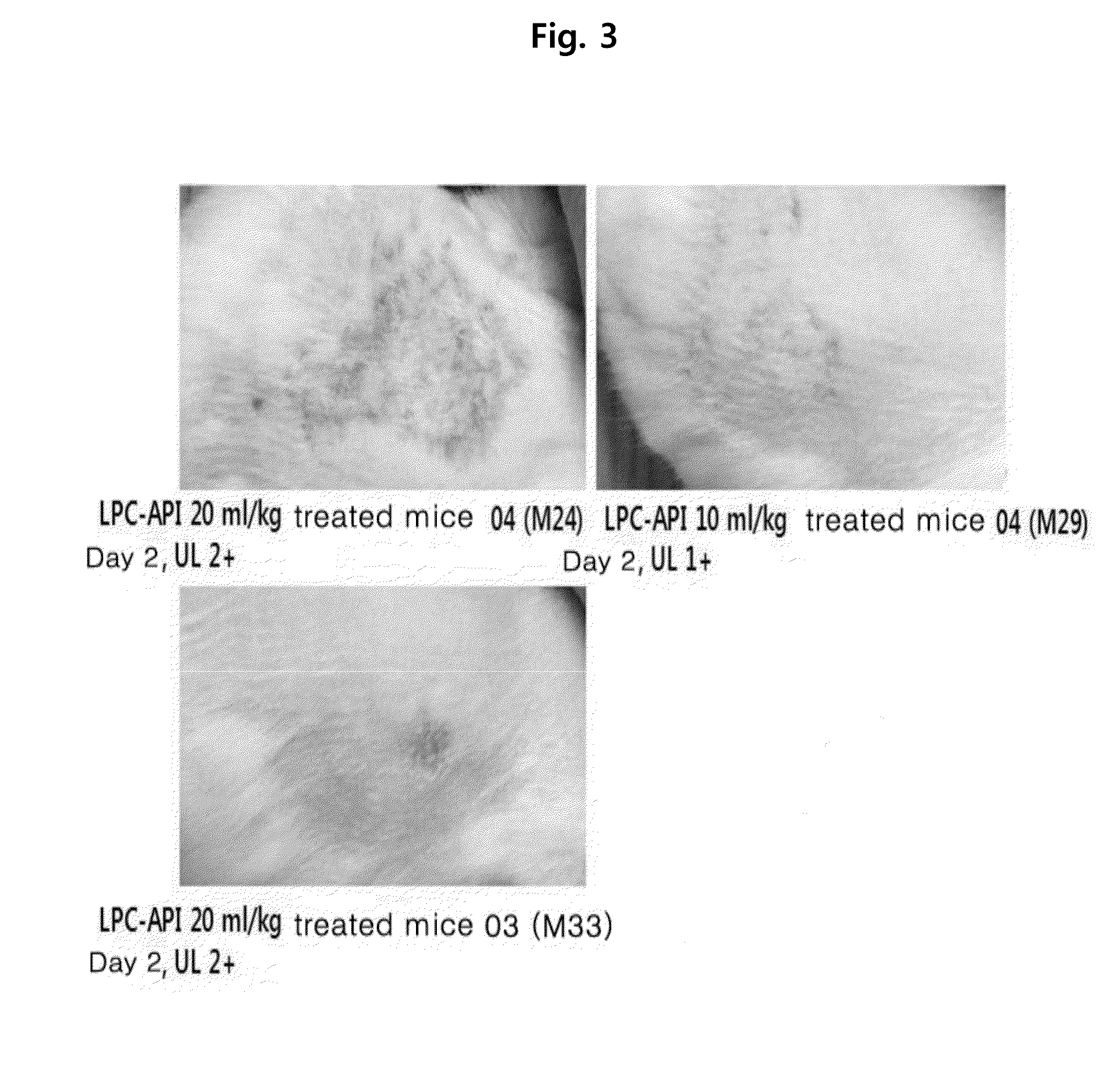 Lipid nanomaterial containing lysophosphatidylcholine or derivative thereof and method for preparing same
