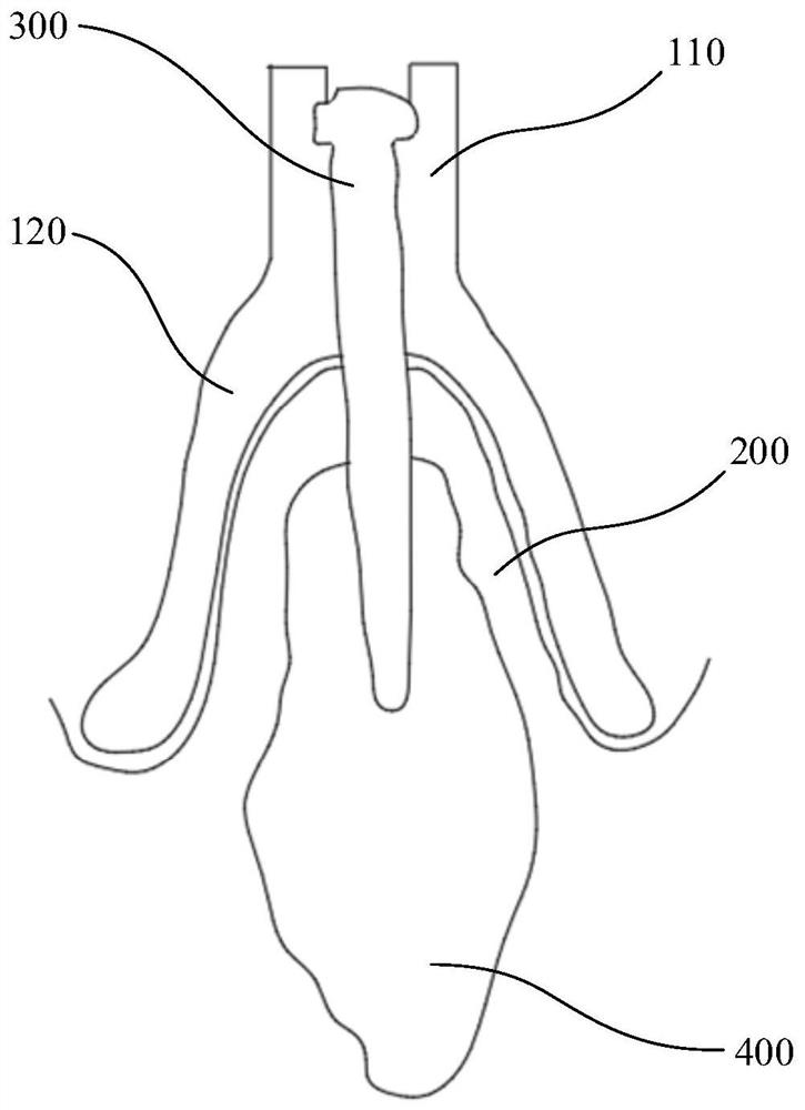 Auxiliary device for frenum deepening surgery of edentulous jaw and manufacturing method of auxiliary device