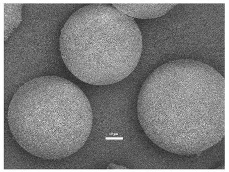 Weak anion chromatography medium, preparation method and application thereof