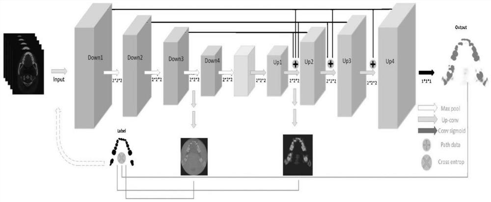 Tooth CT image segmentation method based on 3D multi-feature fusion
