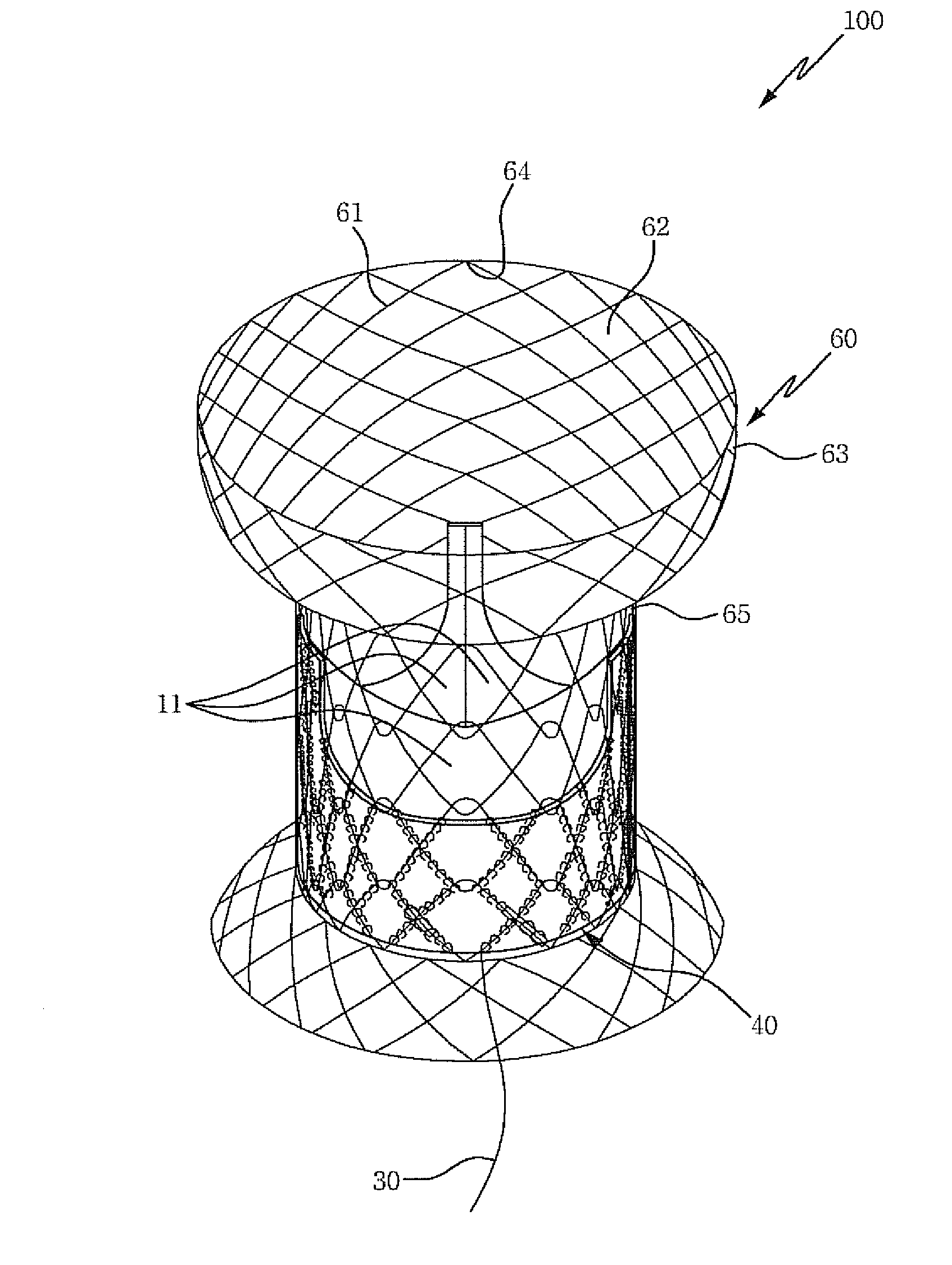 Heart valve prosthesis using different types of living tissue and method of fabricating the same