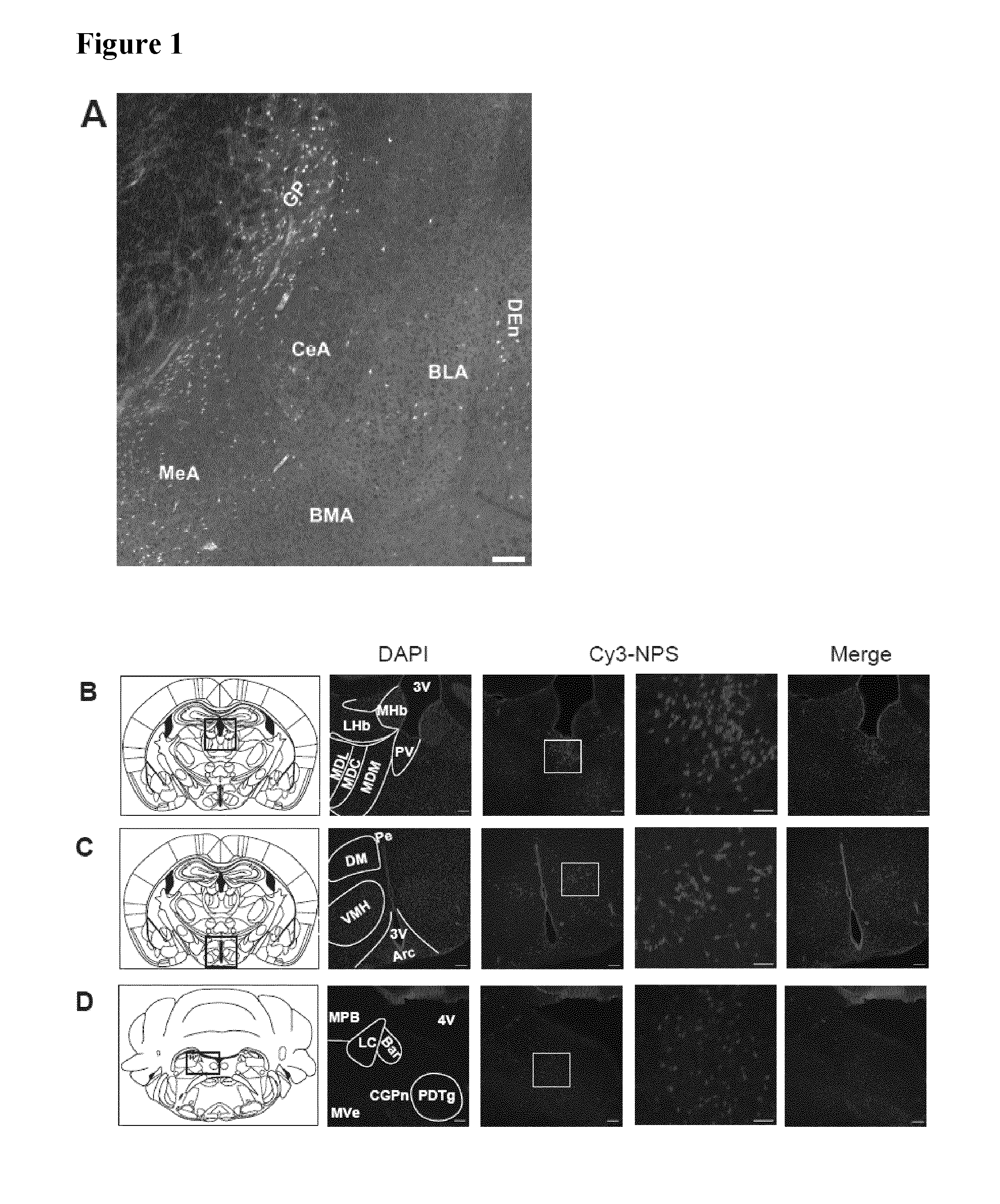 Peptides and pharmaceutical compositions for use in the treatment by nasal administration of patients suffering from anxiety and sleep disorders