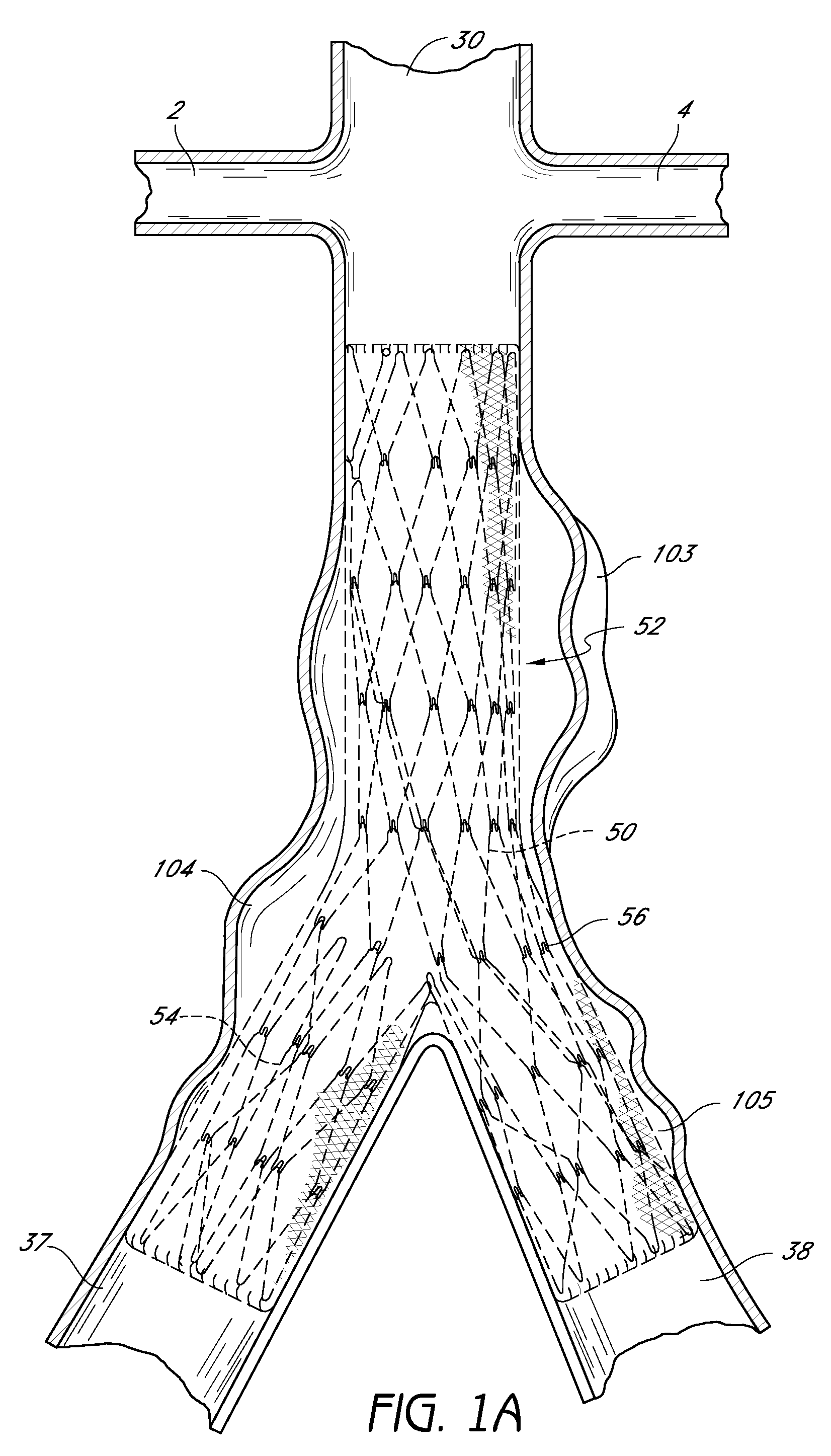 Bifurcated graft deployment systems and methods