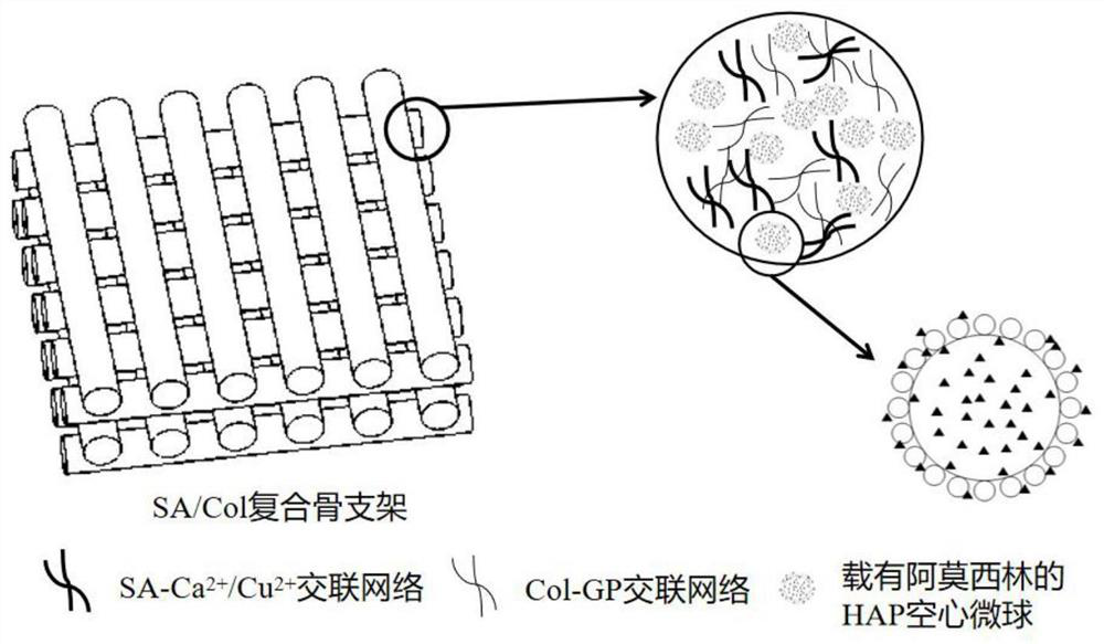 A sodium alginate/collagen composite bone scaffold and its preparation method and application