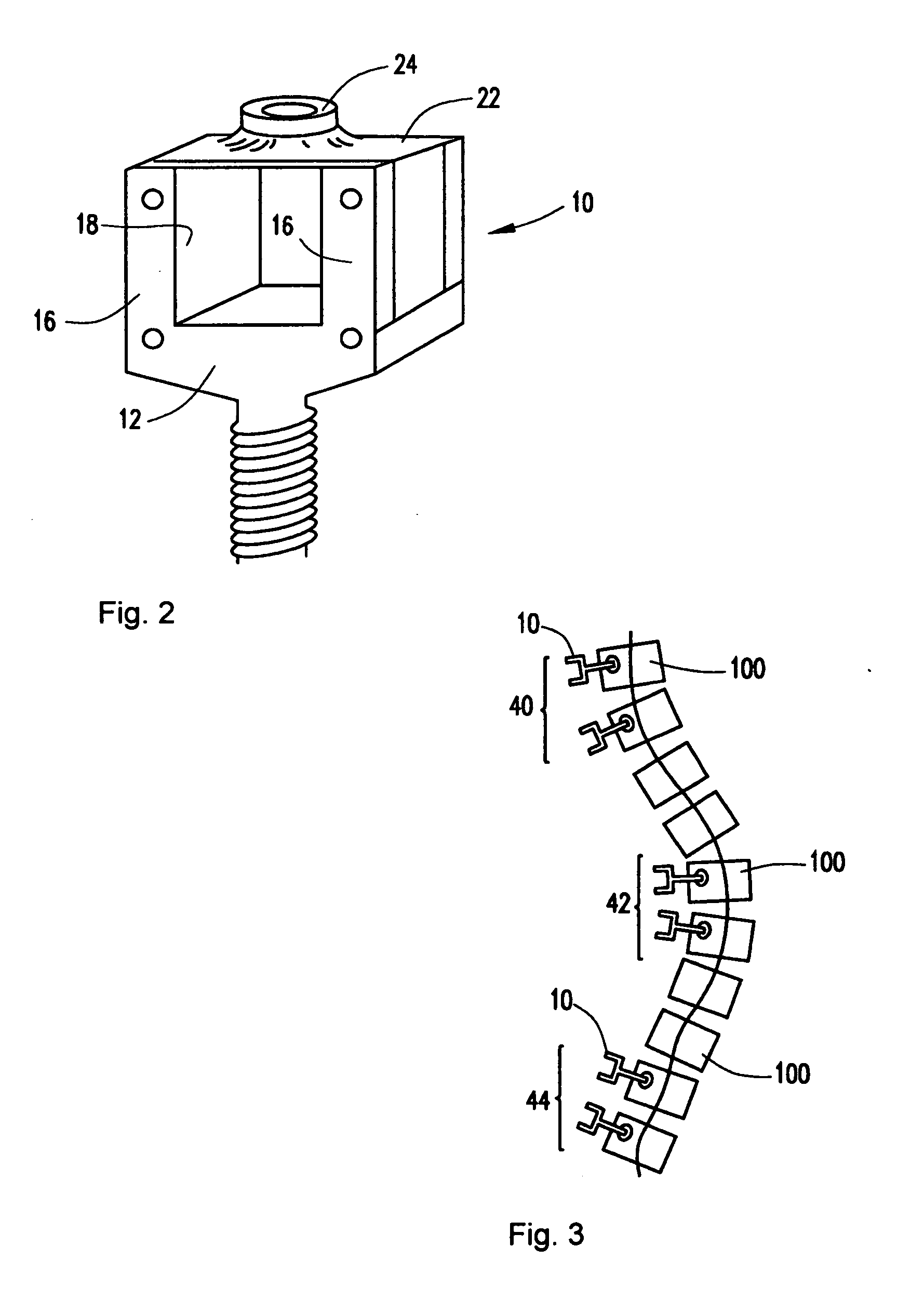 System and method for aligning vertebrae in the amelioration of aberrant spinal column deviation condition in patients requiring the accomodation of spinal column growth or elongation