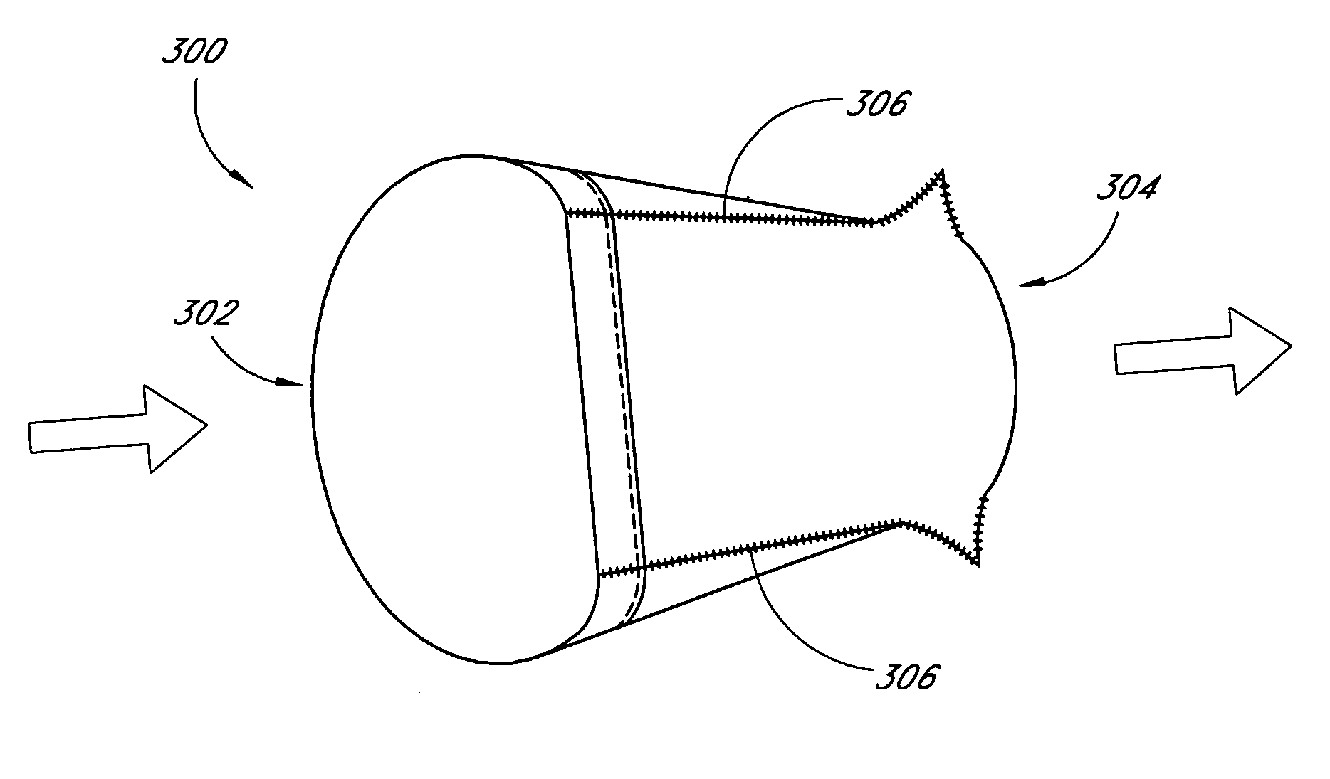 Prosthetic heart valve