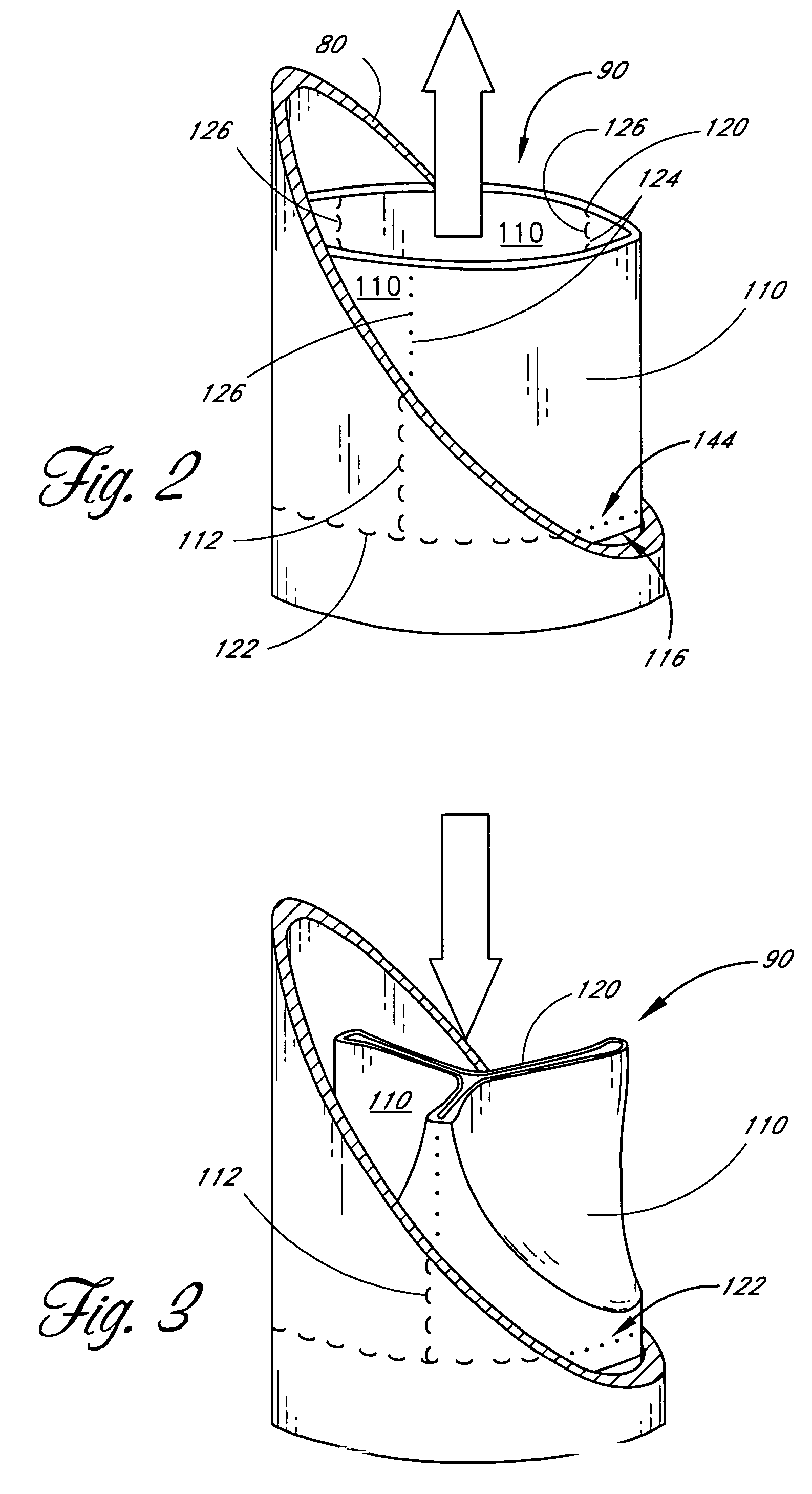 Prosthetic heart valve