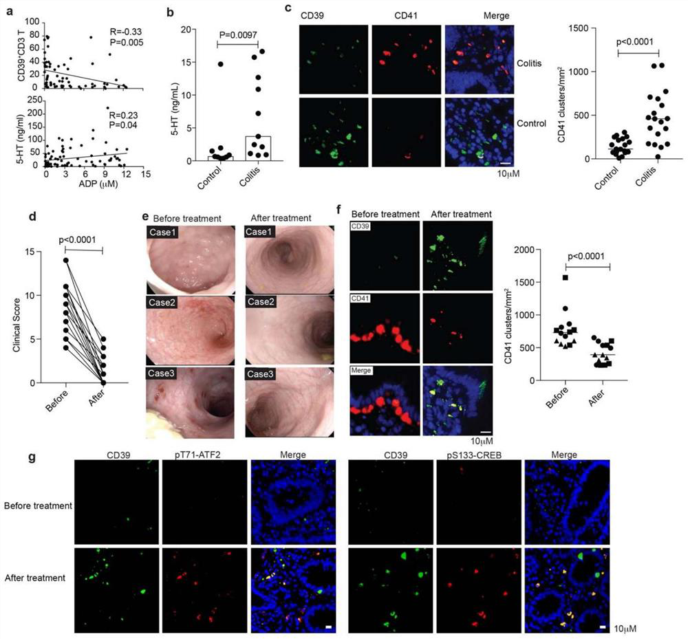 Immune mechanism and therapeutic drug for gastrointestinal diseases