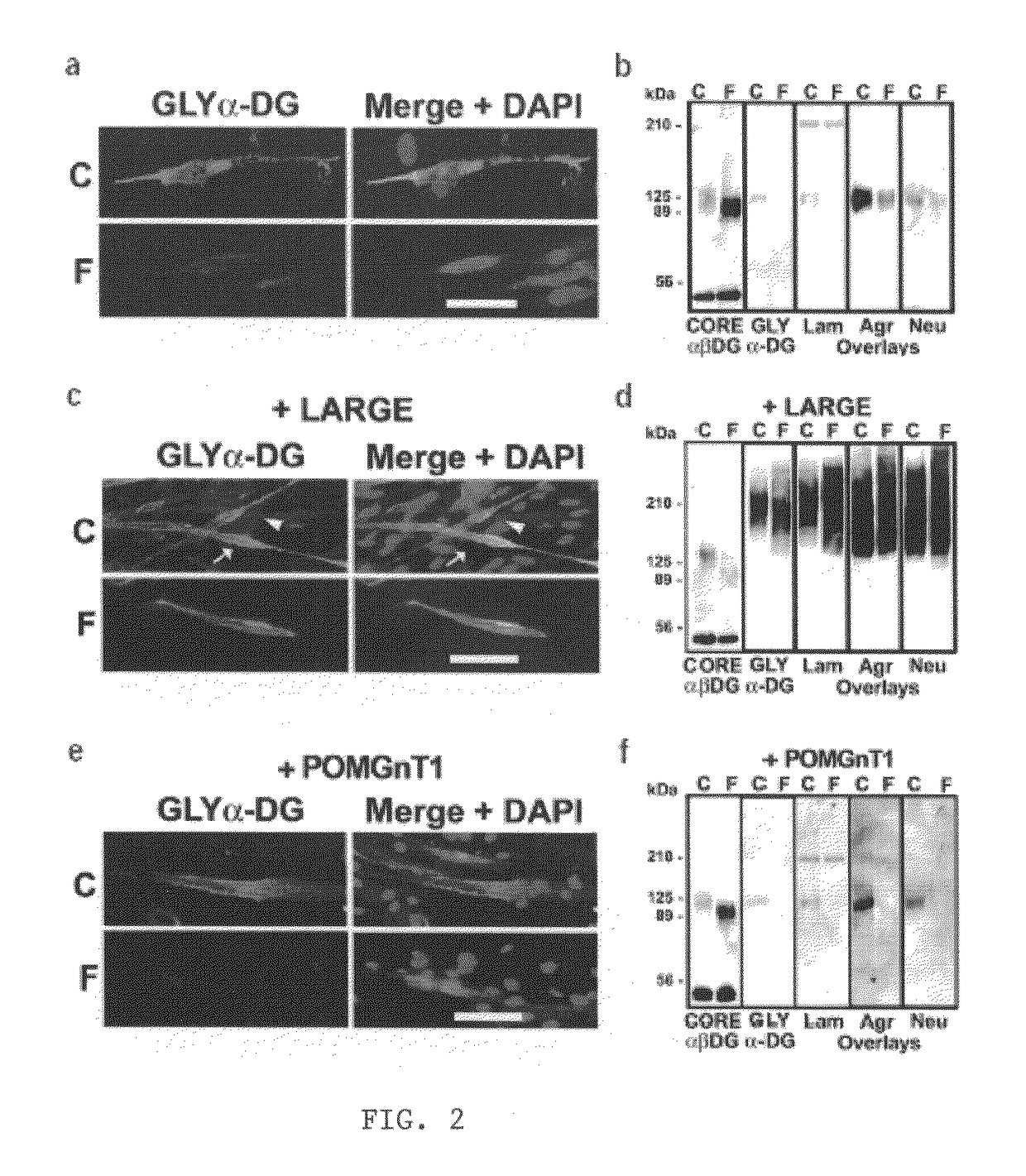 Increasing functional glycosylation of alpha-dystroglycan in the treatment of muscle degeneration