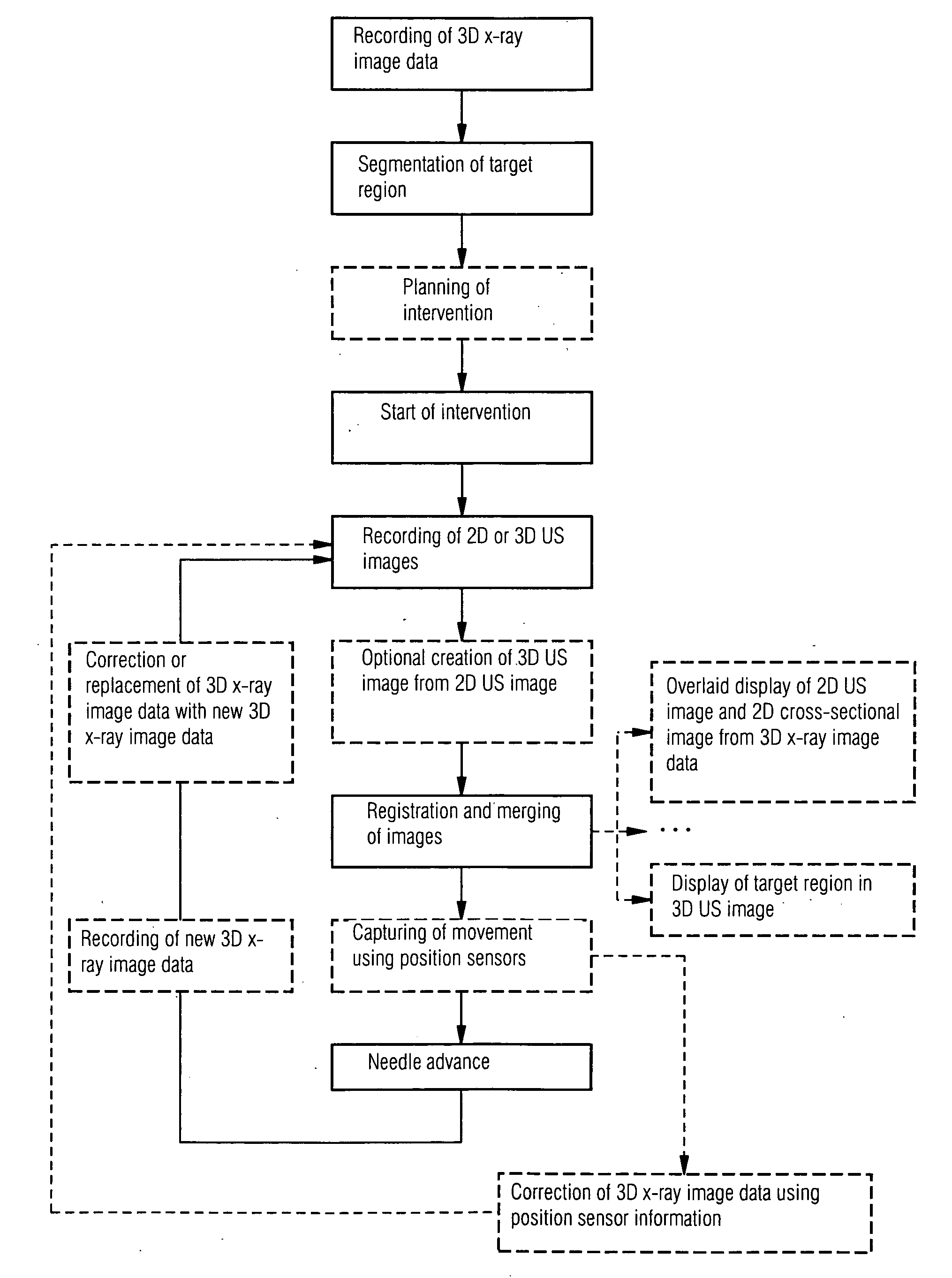 Method for assisting with percutaneous interventions