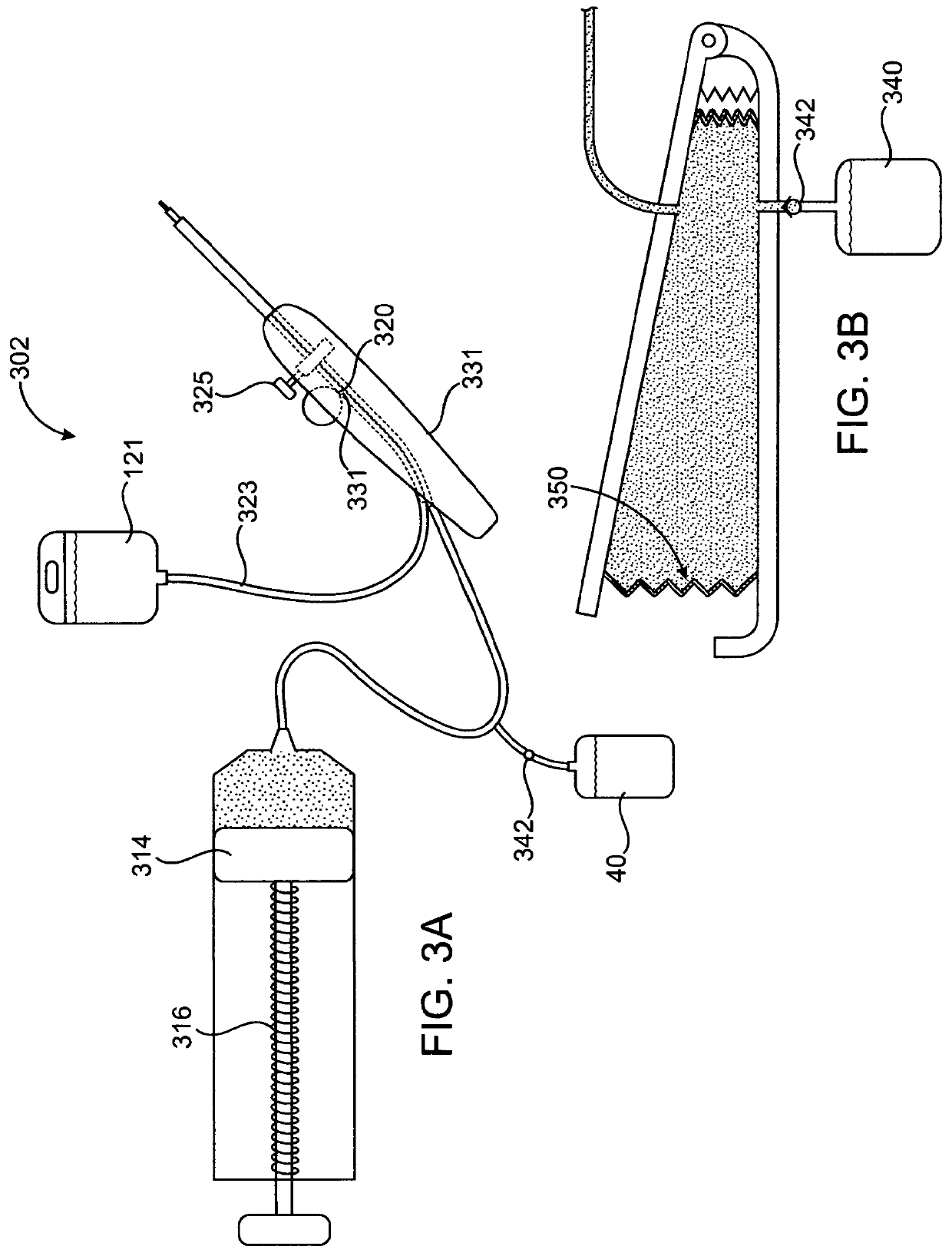 Devices and methods for ocular surgery